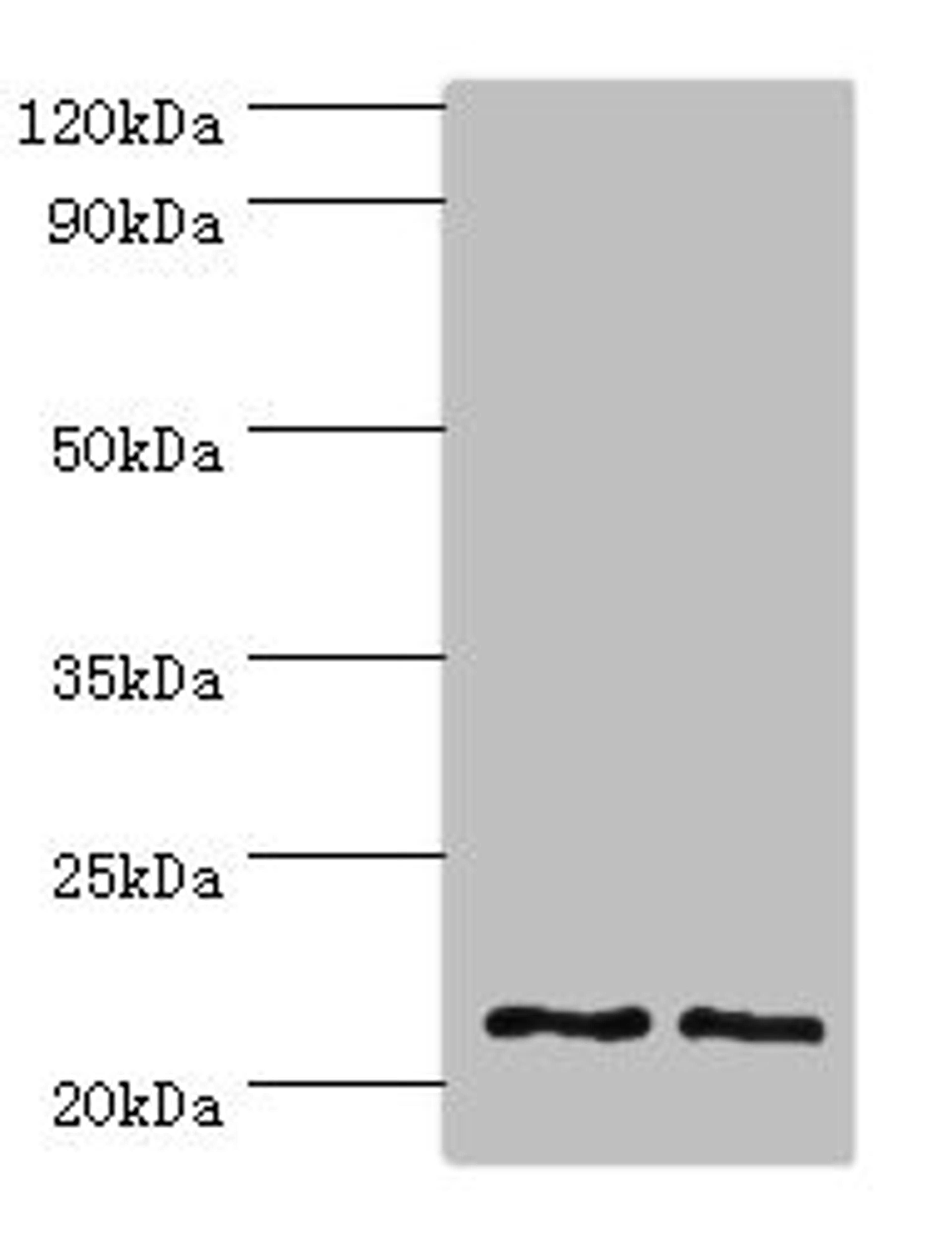 Western blot. All lanes: DNAL1 antibody at 4ug/ml. Lane 1: Hela whole cell lysate. Lane 2: HepG2 whole cell lysate. Secondary. Goat polyclonal to rabbit IgG at 1/10000 dilution. Predicted band size: 22, 9, 18 kDa. Observed band size: 22 kDa. 