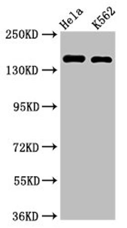 Western Blot. Positive WB detected in: Hela whole cell lysate, K562 whole cell lysate. All lanes: CDK12 antibody at 2µg/ml. Secondary. Goat polyclonal to rabbit IgG at 1/50000 dilution. Predicted band size: 165, 164, 142 kDa. Observed band size: 165 kDa