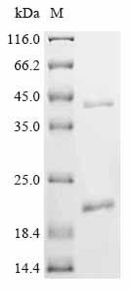 (Tris-Glycine gel) Discontinuous SDS-PAGE (reduced) with 5% enrichment gel and 15% separation gel.