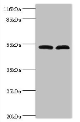 Western blot. All lanes: Protein FAM114A2 antibody at 2ug/ml. Lane 1: Mouse kidney tissue. Lane 2: U251 whole cell lysate. Secondary. Goat polyclonal to rabbit IgG at 1/10000 dilution. Predicted band size: 55 kDa. Observed band size: 55 kDa. 