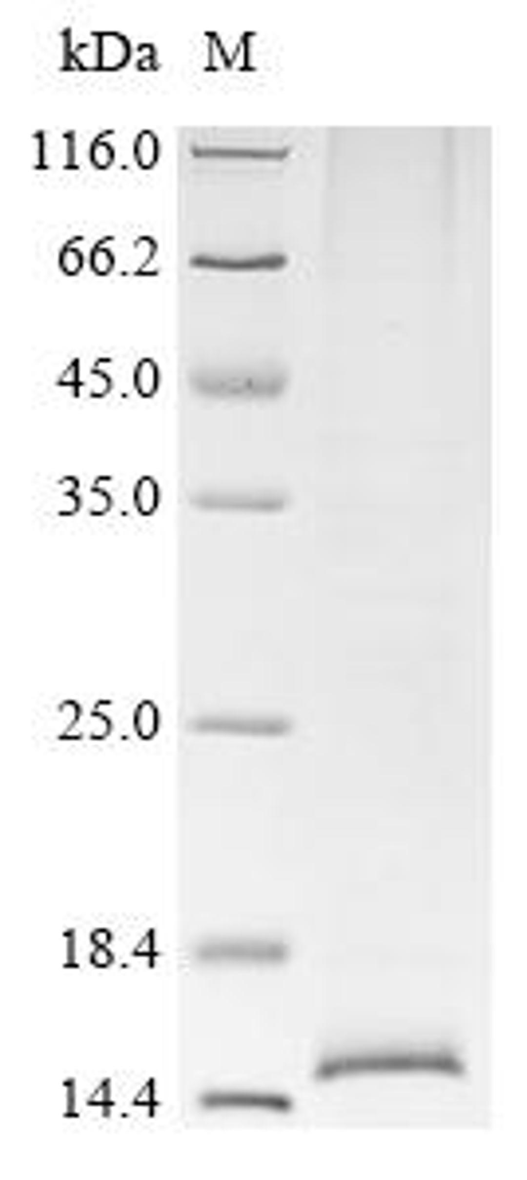 (Tris-Glycine gel) Discontinuous SDS-PAGE (reduced) with 5% enrichment gel and 15% separation gel.