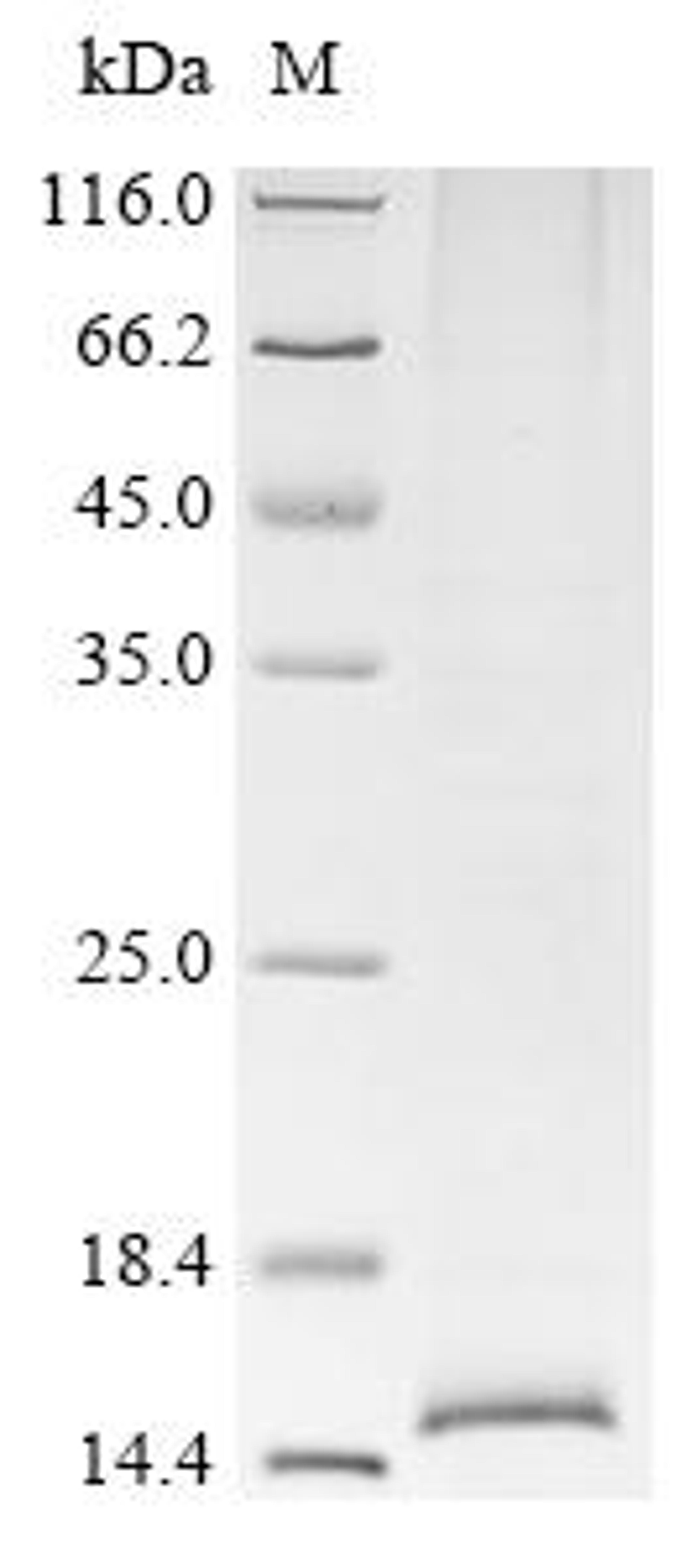 (Tris-Glycine gel) Discontinuous SDS-PAGE (reduced) with 5% enrichment gel and 15% separation gel.