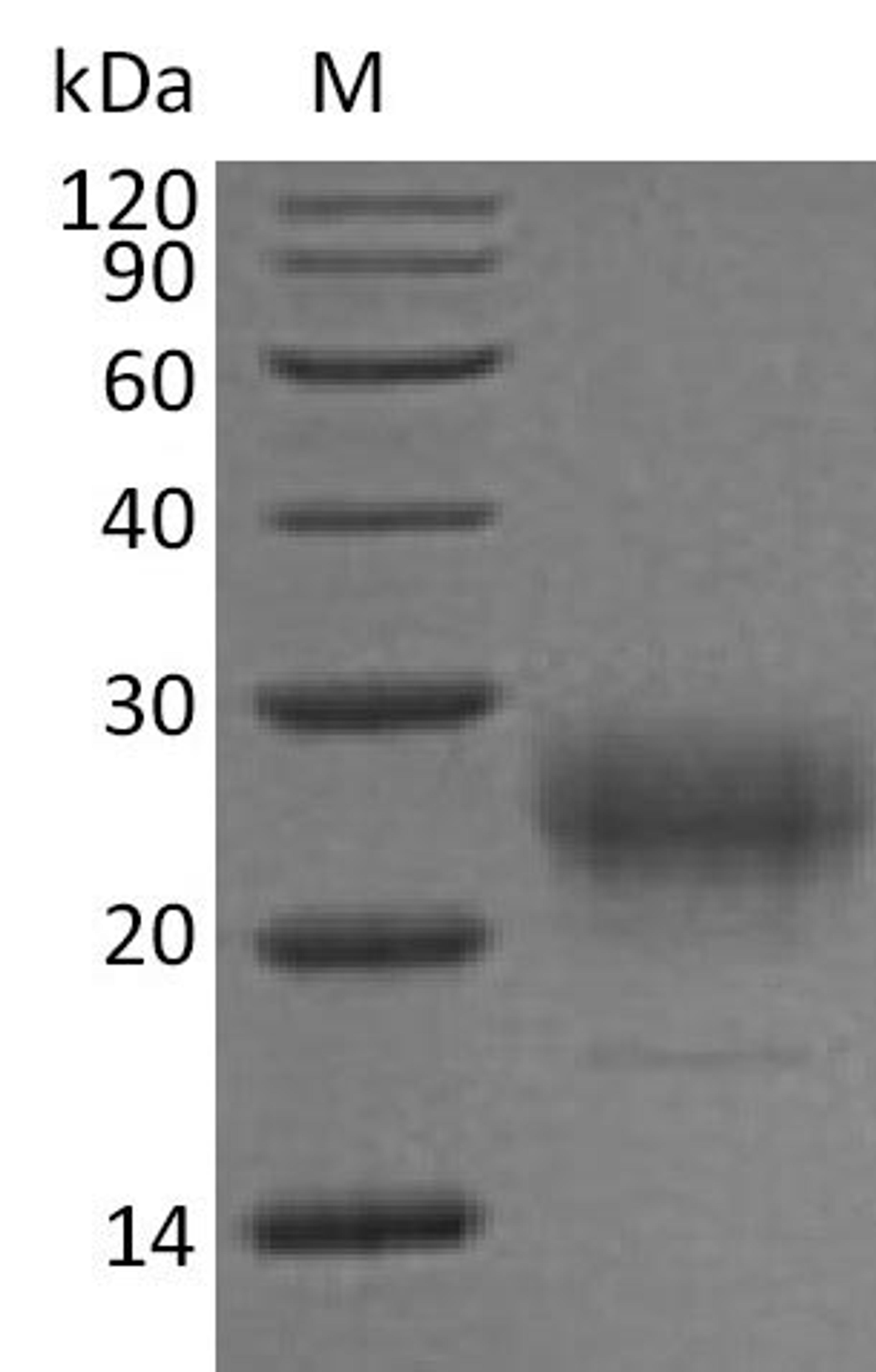 (Tris-Glycine gel) Discontinuous SDS-PAGE (reduced) with 5% enrichment gel and 15% separation gel.