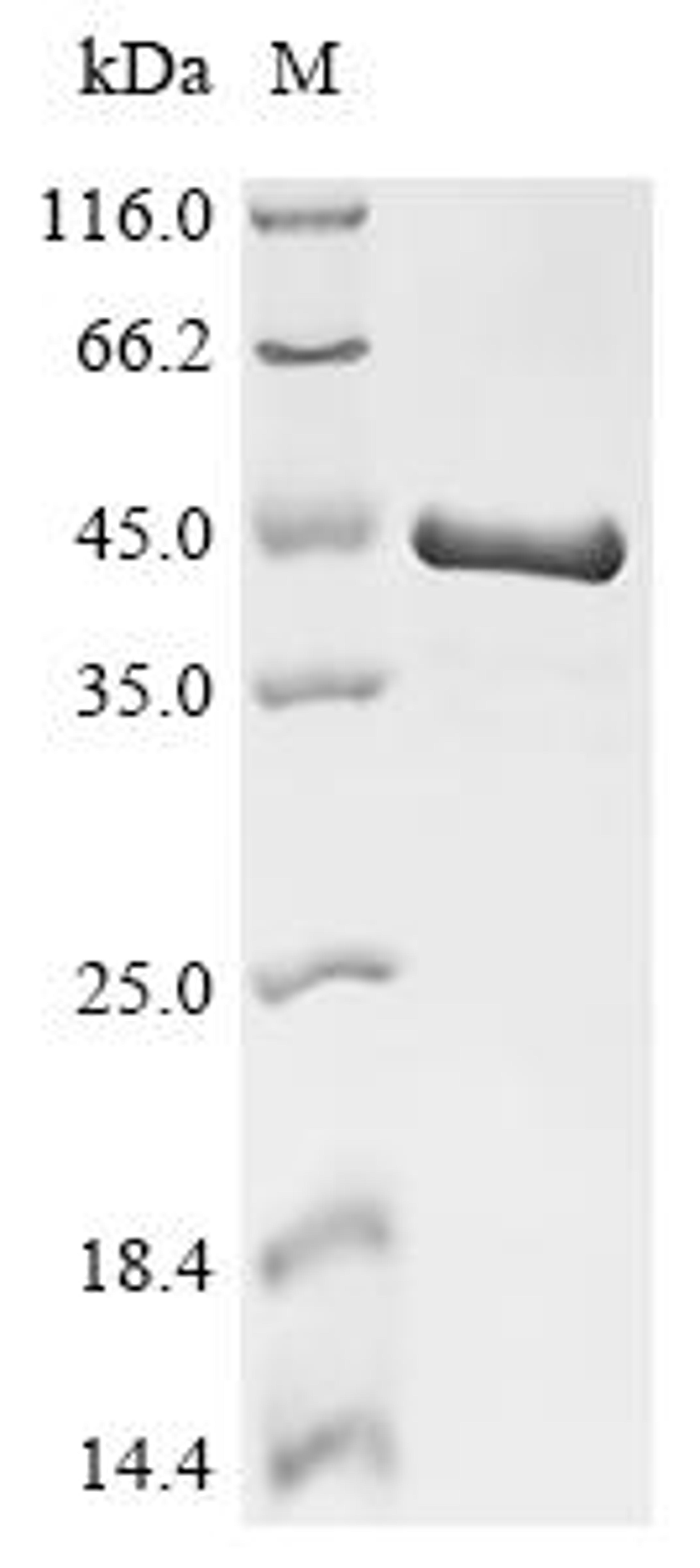 (Tris-Glycine gel) Discontinuous SDS-PAGE (reduced) with 5% enrichment gel and 15% separation gel.
