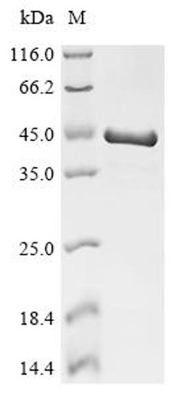 (Tris-Glycine gel) Discontinuous SDS-PAGE (reduced) with 5% enrichment gel and 15% separation gel.