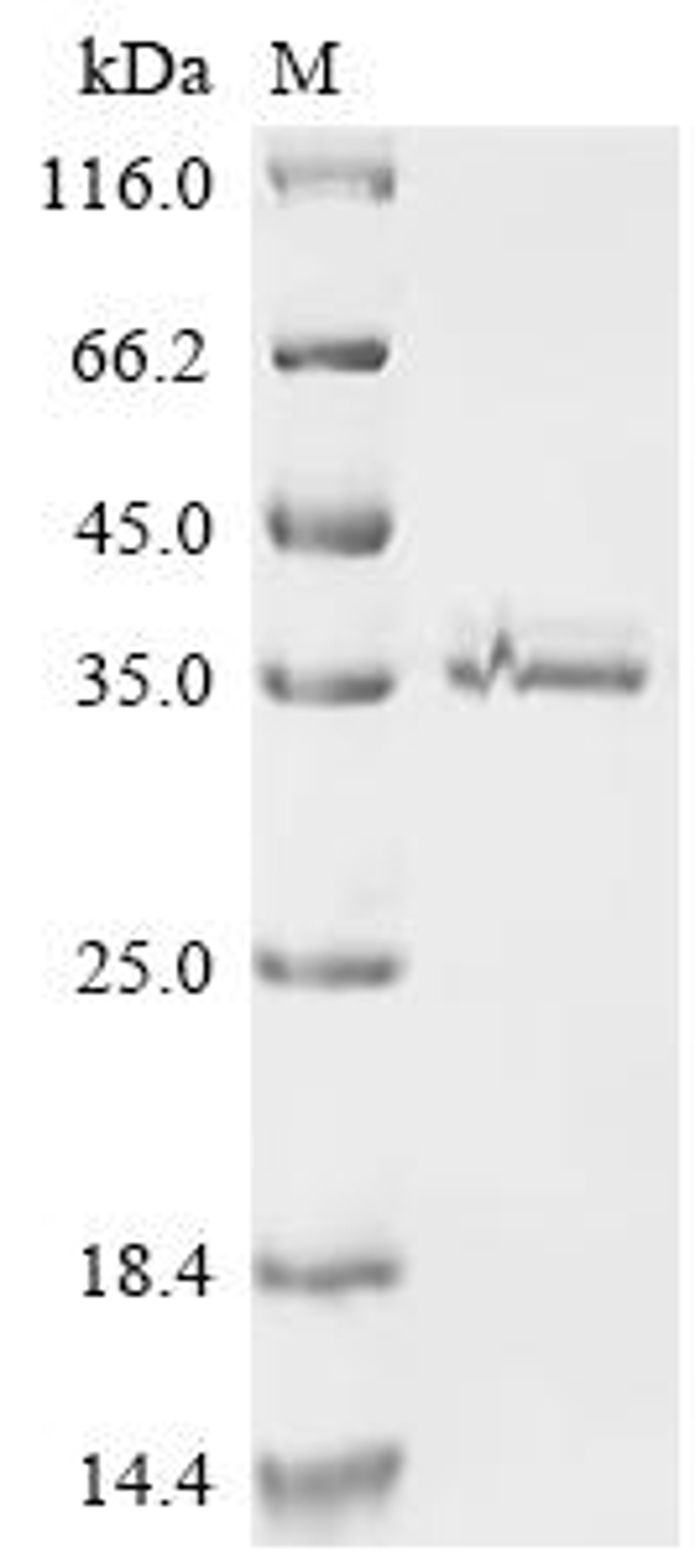 (Tris-Glycine gel) Discontinuous SDS-PAGE (reduced) with 5% enrichment gel and 15% separation gel.
