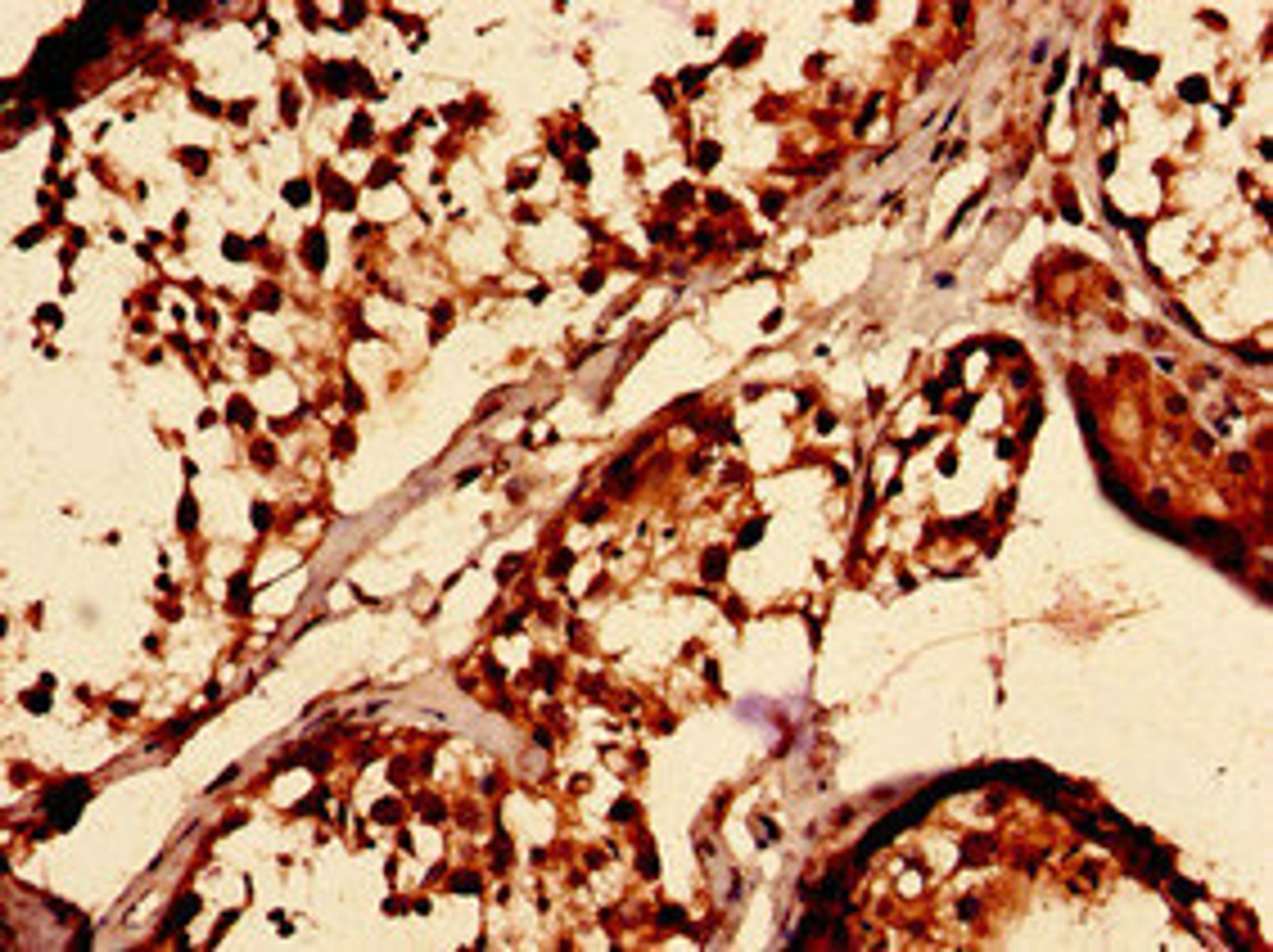 Immunocytochemistry analysis of human testis tissue using CSB-PA023181EA01HU at dilution of 1:100