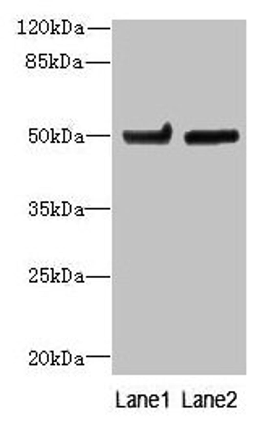 Western blot. All lanes: TUBB6 antibody at 4ug/ml. Lane 1: Hela whole cell lysate. Lane 2: MDA-MB-231 whole cell lysate. Secondary. Goat polyclonal to rabbit IgG at 1/10000 dilution. Predicted band size: 50 kDa. Observed band size: 50 kDa. 