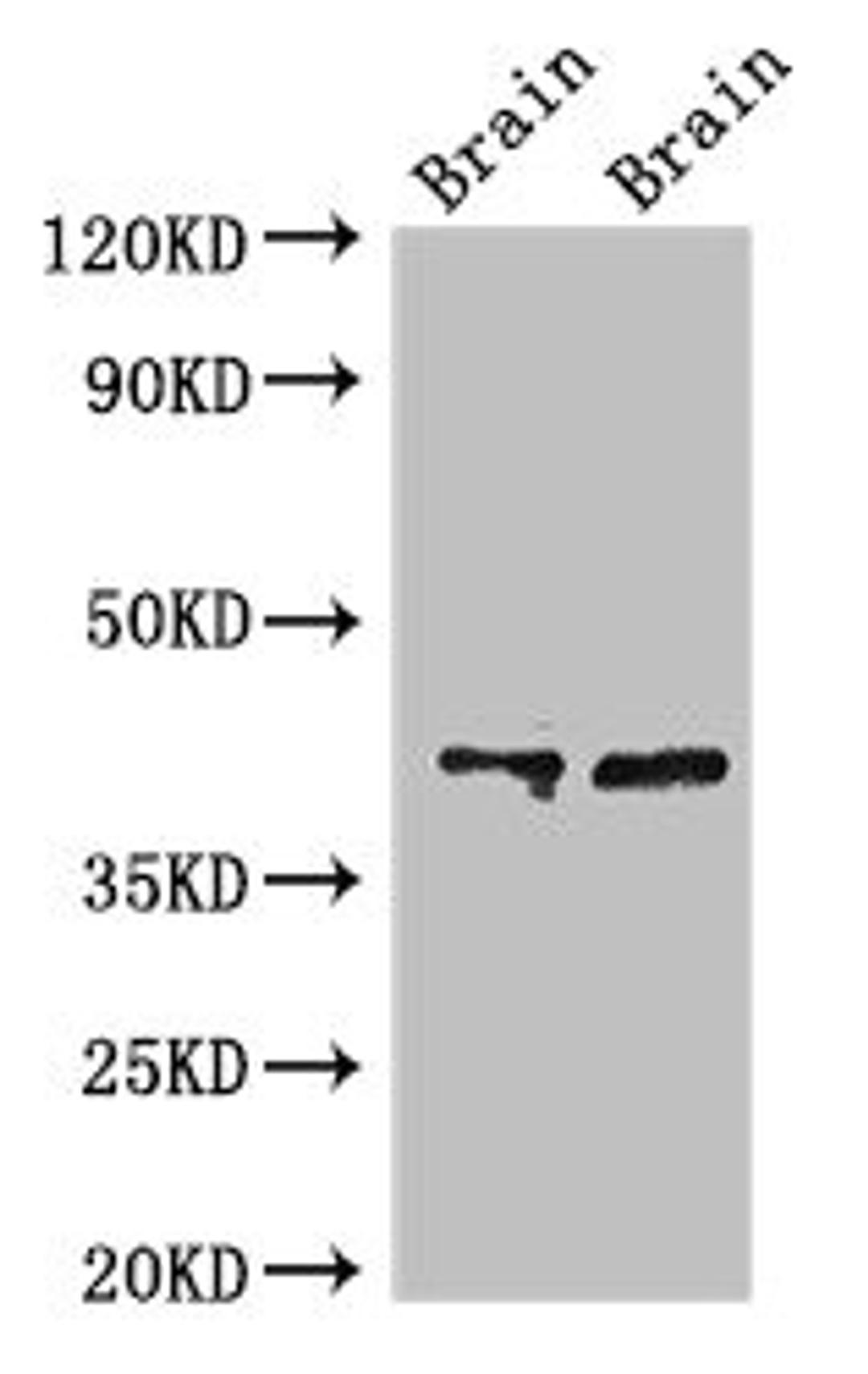 Western Blot. Positive WB detected in: Rat brain tissue, Mouse brain tissue. All lanes: CAMK1 antibody at 3ug/ml. Secondary. Goat polyclonal to rabbit IgG at 1/50000 dilution. Predicted band size: 42 kDa. Observed band size: 42 kDa. 