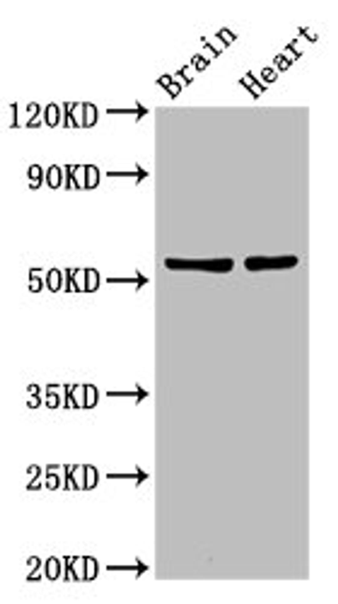 Western Blot. Positive WB detected in: Rat brain tisseu, Rat heart tissue. All lanes: RBM45 antibody at 12ug/ml. Secondary. Goat polyclonal to rabbit IgG at 1/50000 dilution. Predicted band size: 54, 38 kDa. Observed band size: 54 kDa. 