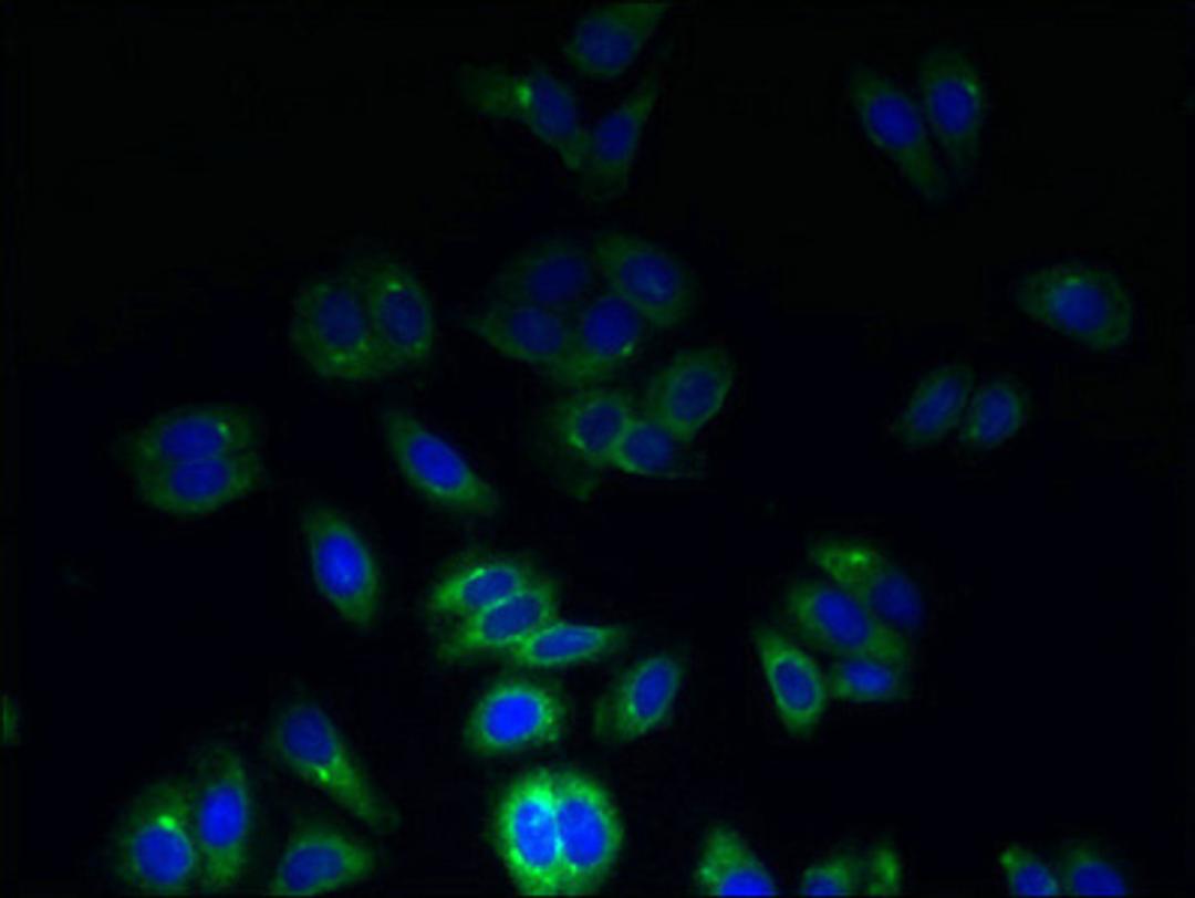 Immunofluorescent analysis of HepG2 cells using CSB-PA025165LA01HU at dilution of 1:100 and Alexa Fluor 488-congugated AffiniPure Goat Anti-Rabbit IgG(H+L)