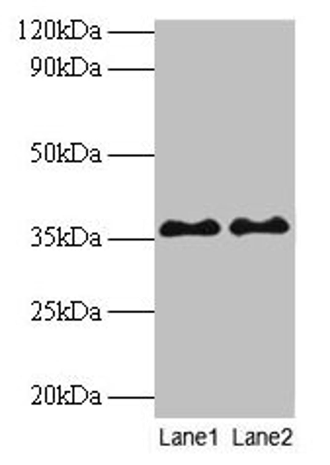 Western blot. All lanes: SUPT3H antibody at 2µg/ml. Lane 1: Mouse brain tissue. Lane 2: Colo320 whole cell lysate. Secondary. Goat polyclonal to rabbit IgG at 1/10000 dilution. Predicted band size: 36, 38 kDa. Observed band size: 36 kDa