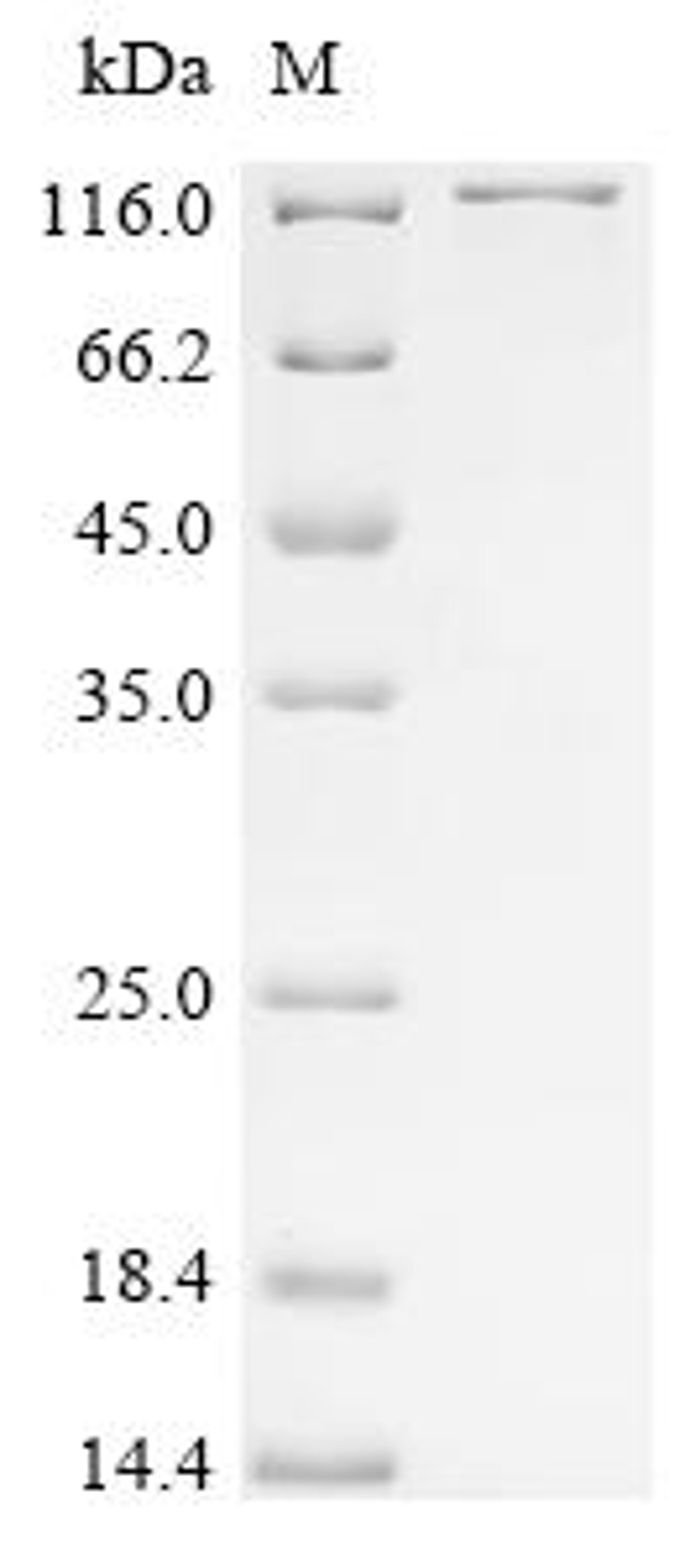 (Tris-Glycine gel) Discontinuous SDS-PAGE (reduced) with 5% enrichment gel and 15% separation gel.