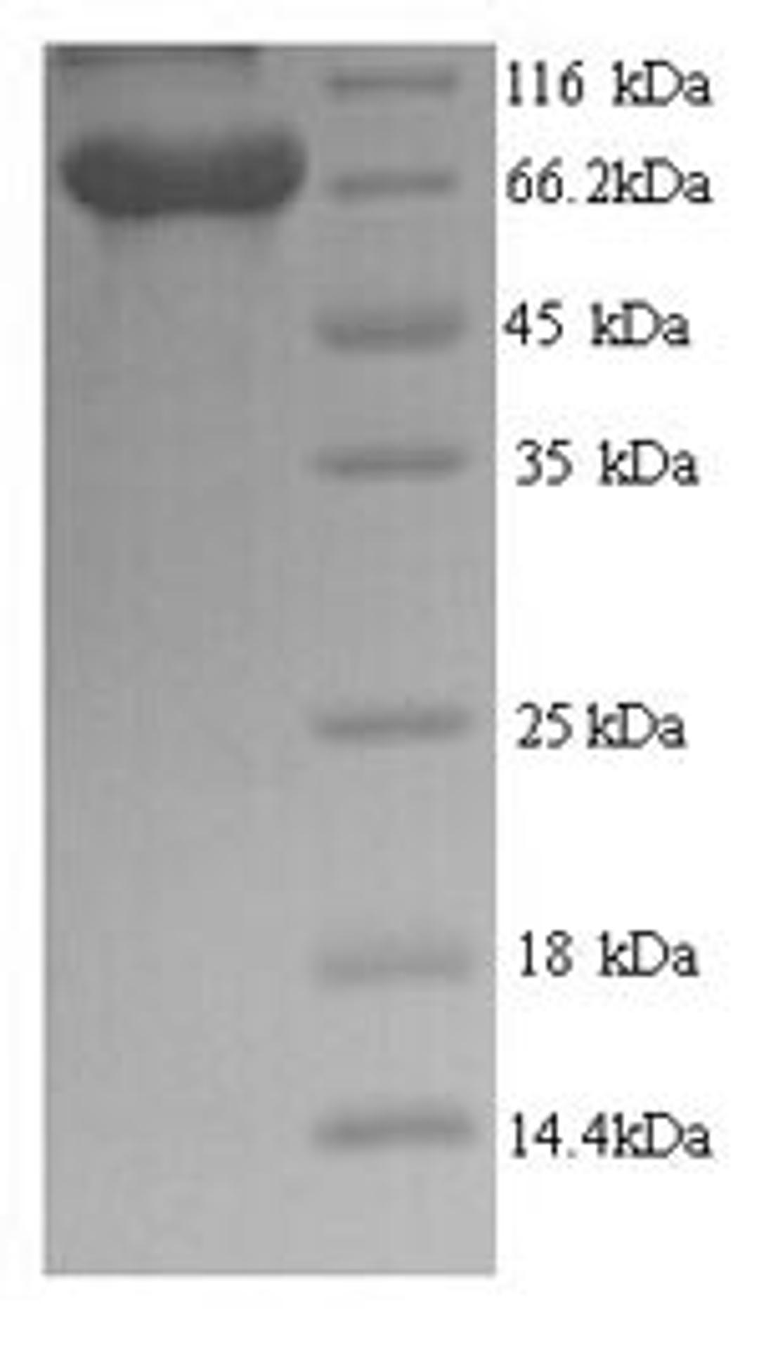 (Tris-Glycine gel) Discontinuous SDS-PAGE (reduced) with 5% enrichment gel and 15% separation gel.
