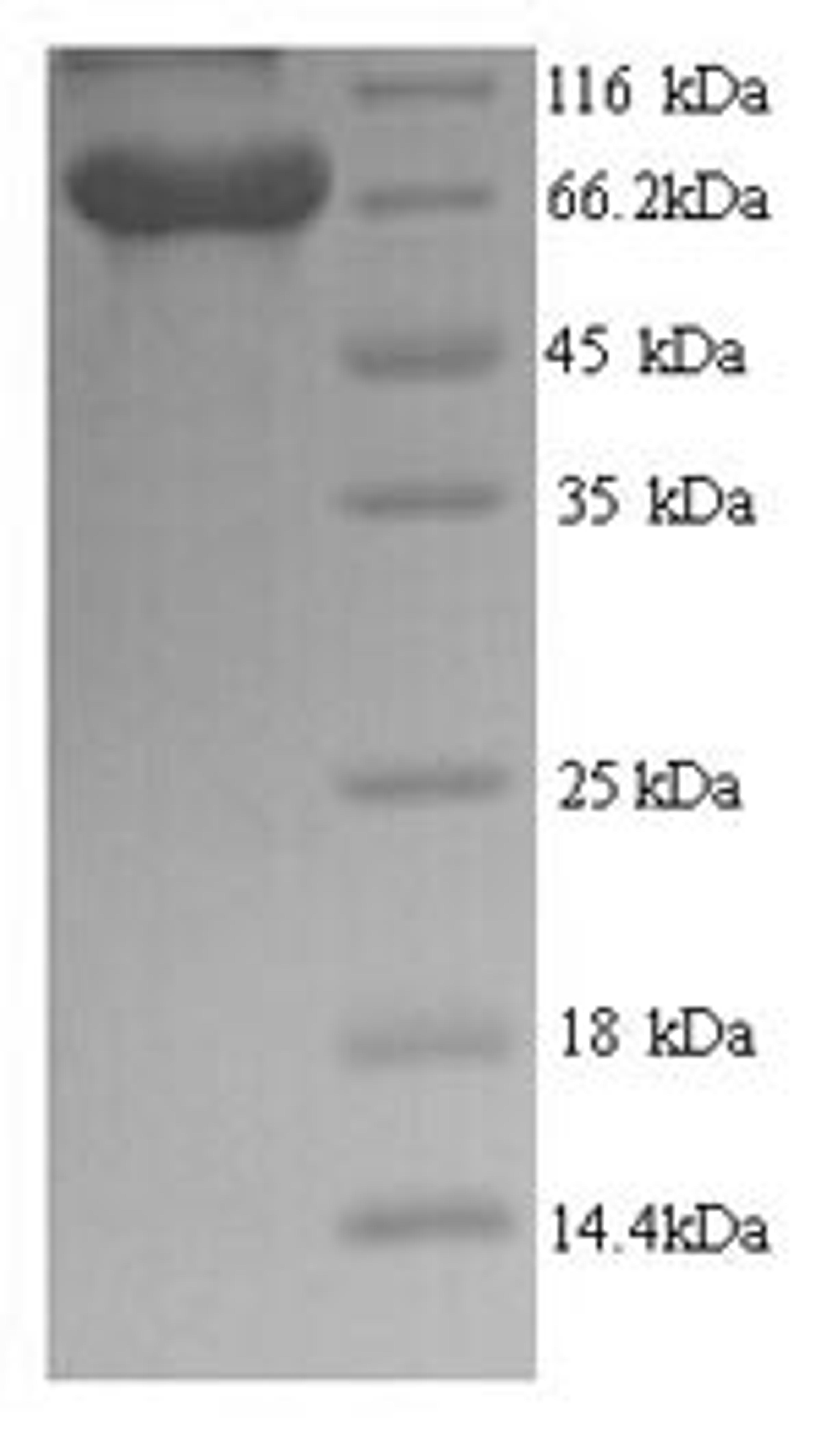 (Tris-Glycine gel) Discontinuous SDS-PAGE (reduced) with 5% enrichment gel and 15% separation gel.