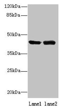 Western blot. All lanes: NIF3L1 antibody at 0.2ug/ml. Lane 1: 293T whole cell lysate. Lane 2: MDA-MB-231 whole cell lysate. Secondary. Goat polyclonal to rabbit IgG at 1/10000 dilution. Predicted band size: 42, 39, 33 kDa. Observed band size: 42 kDa. 