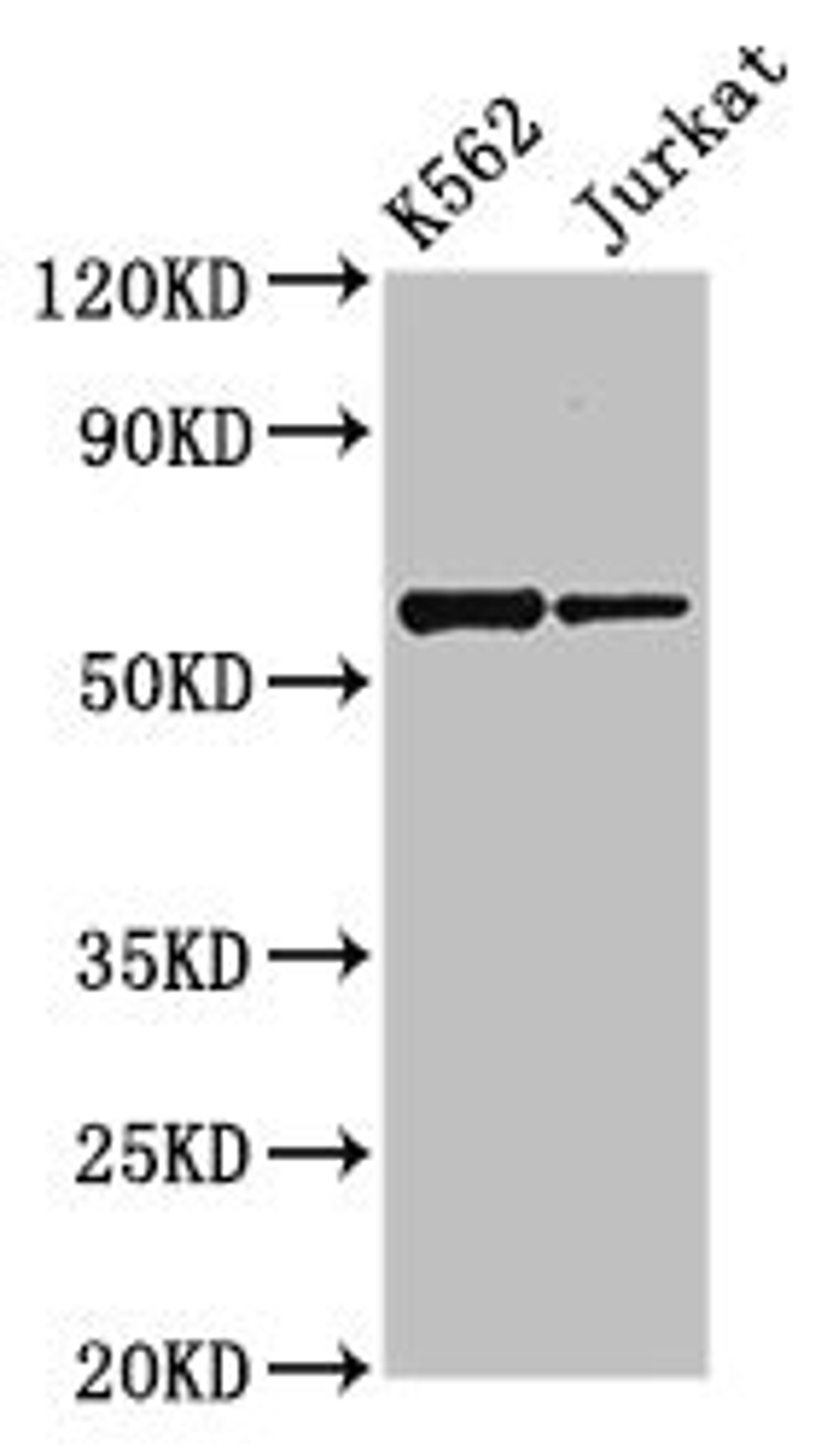 Western Blot. Positive WB detected in: K562 whole cell lysate, Jurkat whole cell lysate. All lanes: NAMPT antibody at 2.7µg/ml. Secondary. Goat polyclonal to rabbit IgG at 1/50000 dilution. Predicted band size: 56 kDa. Observed band size: 56 kDa
