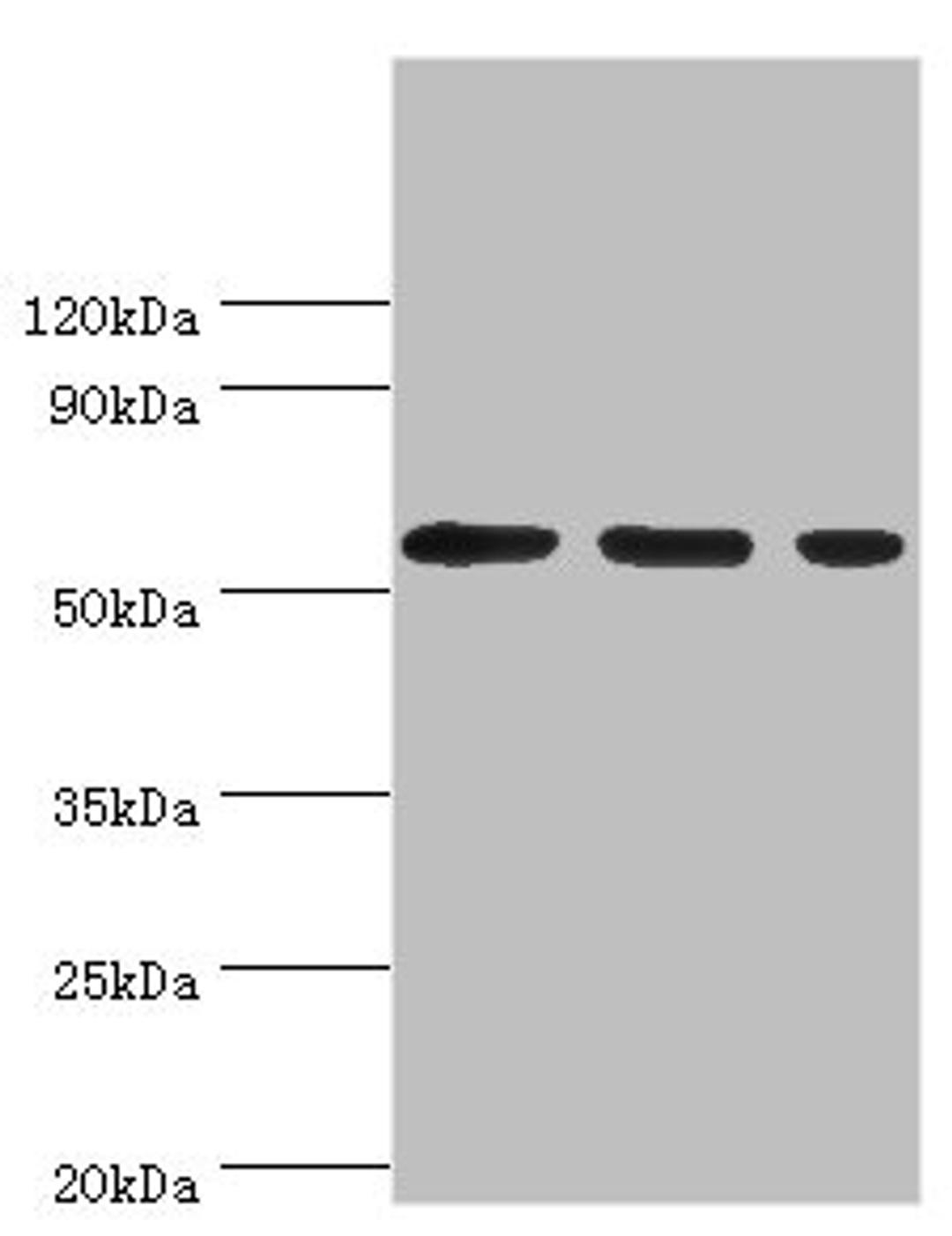 Western blot. All lanes: Aladin antibody at 5ug/ml. Lane 1: Hela whole cell lysate. Lane 2: Mouse brain tissue. Lane 3: NIH/3T3 whole cell lysate. Secondary. Goat polyclonal to rabbit IgG at 1/10000 dilution. Predicted band size: 60, 56 kDa. Observed band size: 60 kDa. 