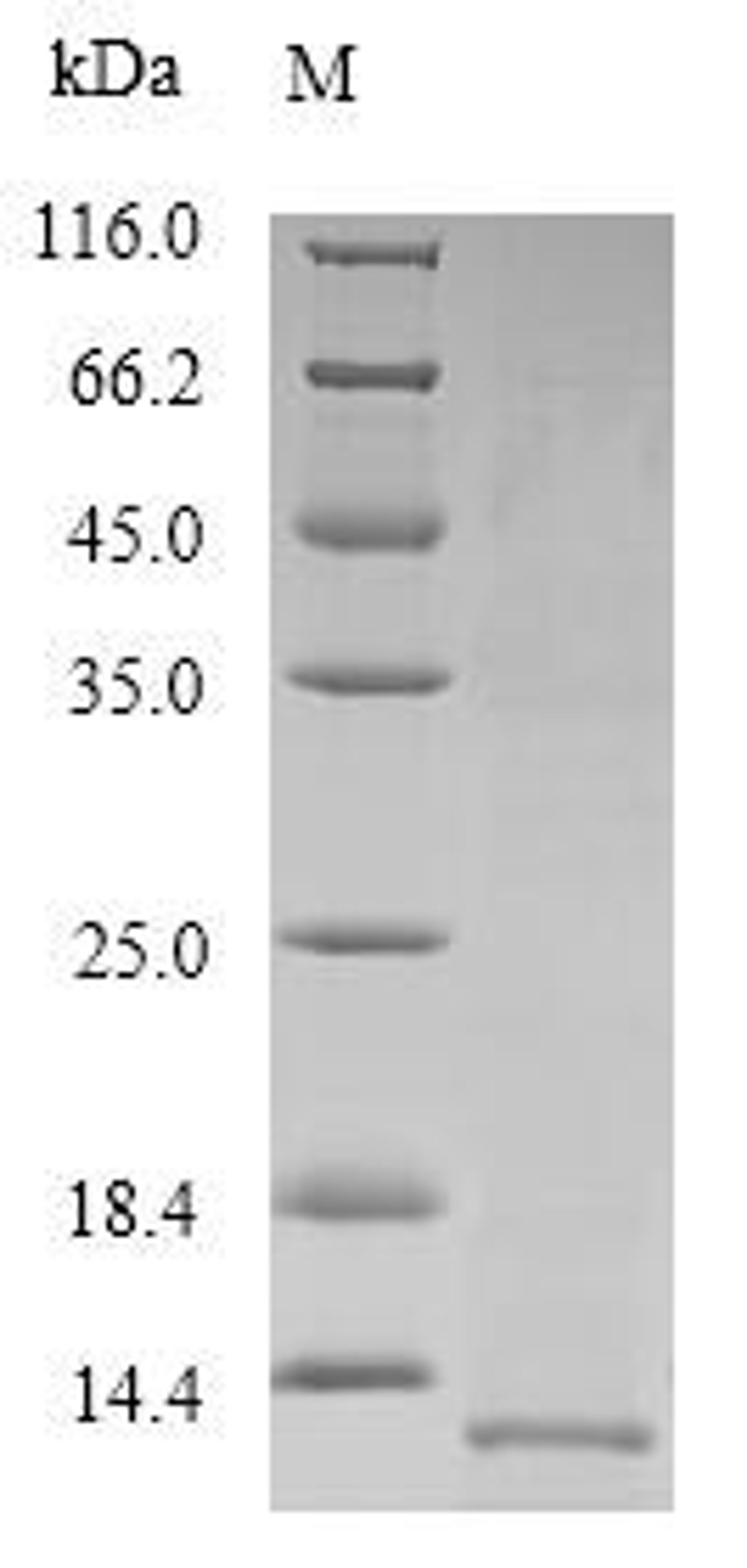 (Tris-Glycine gel) Discontinuous SDS-PAGE (reduced) with 5% enrichment gel and 15% separation gel.