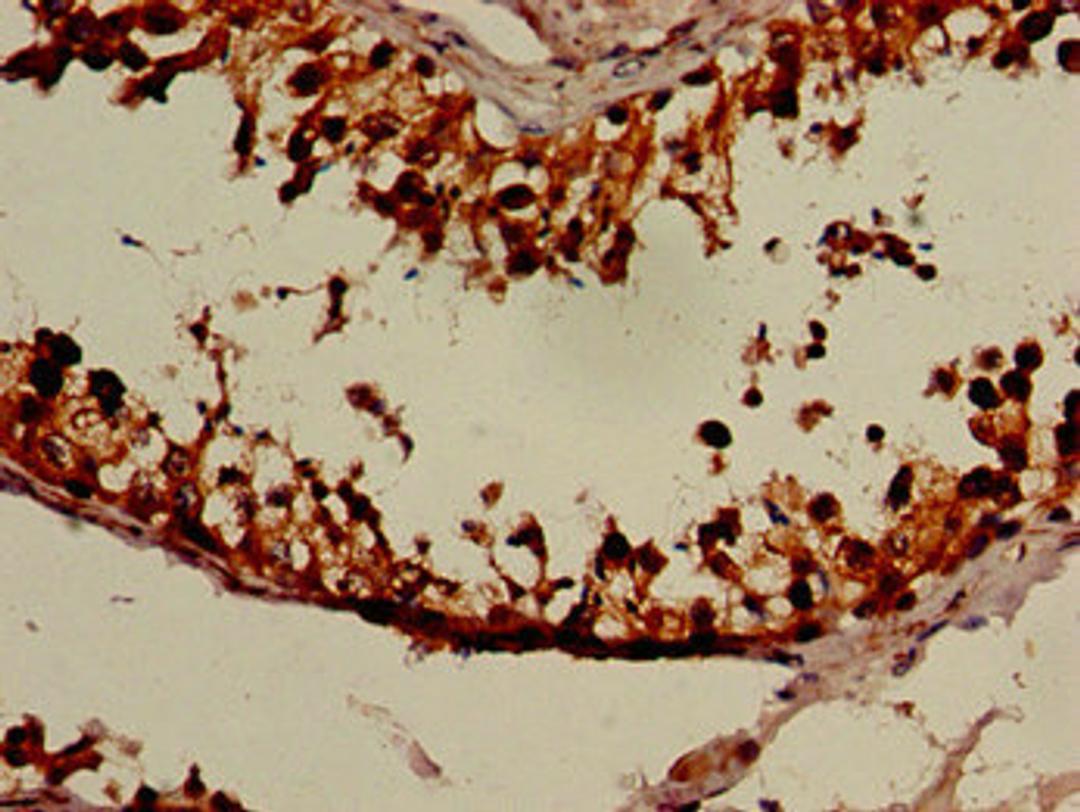 Immunohistochemistry of paraffin-embedded human testis tissue using CSB-PA015438LA01HU at dilution of 1:100