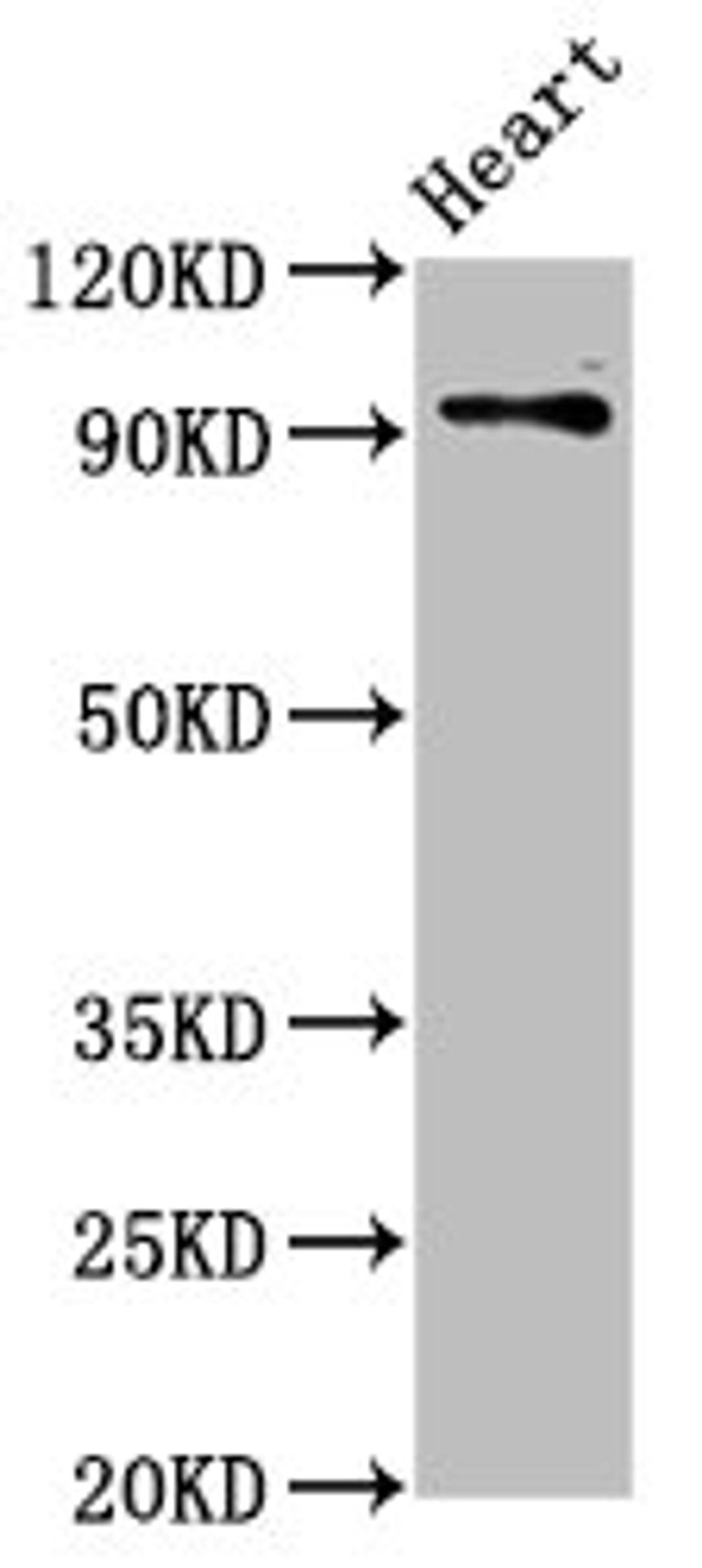 Western Blot. Positive WB detected in: Rat heart tissue. All lanes: DLG2 antibody at 2.8ug/ml. Secondary. Goat polyclonal to rabbit IgG at 1/50000 dilution. Predicted band size: 98, 110, 84, 101, 39 kDa. Observed band size: 98 kDa. 