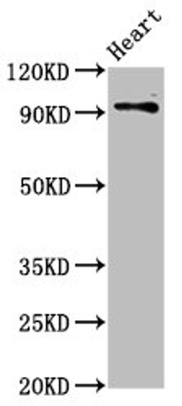 Western Blot. Positive WB detected in: Rat heart tissue. All lanes: DLG2 antibody at 2.8ug/ml. Secondary. Goat polyclonal to rabbit IgG at 1/50000 dilution. Predicted band size: 98, 110, 84, 101, 39 kDa. Observed band size: 98 kDa. 
