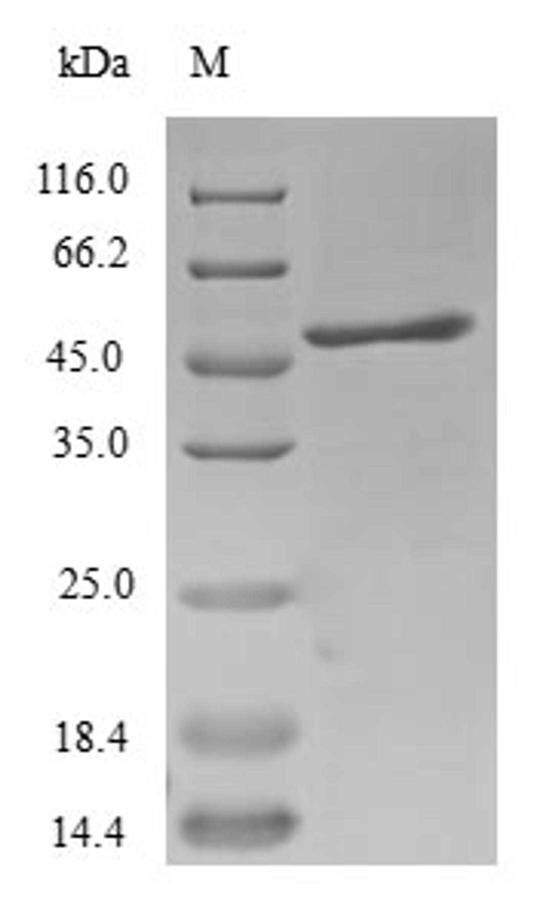 (Tris-Glycine gel) Discontinuous SDS-PAGE (reduced) with 5% enrichment gel and 15% separation gel.