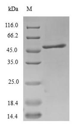 (Tris-Glycine gel) Discontinuous SDS-PAGE (reduced) with 5% enrichment gel and 15% separation gel.