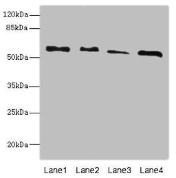 Western blot. All lanes: RTKN antibody at 4.66ug/ml. Lane 1: A431 whole cell lysate. Lane 2: HepG2 whole cell lysate. Lane 3: MCF-7 whole cell lysate. Lane 4: Mouse brain tissue. Secondary. Goat polyclonal to rabbit IgG at 1/10000 dilution. Predicted band size: 63, 62, 57 kDa. Observed band size: 63 kDa. 