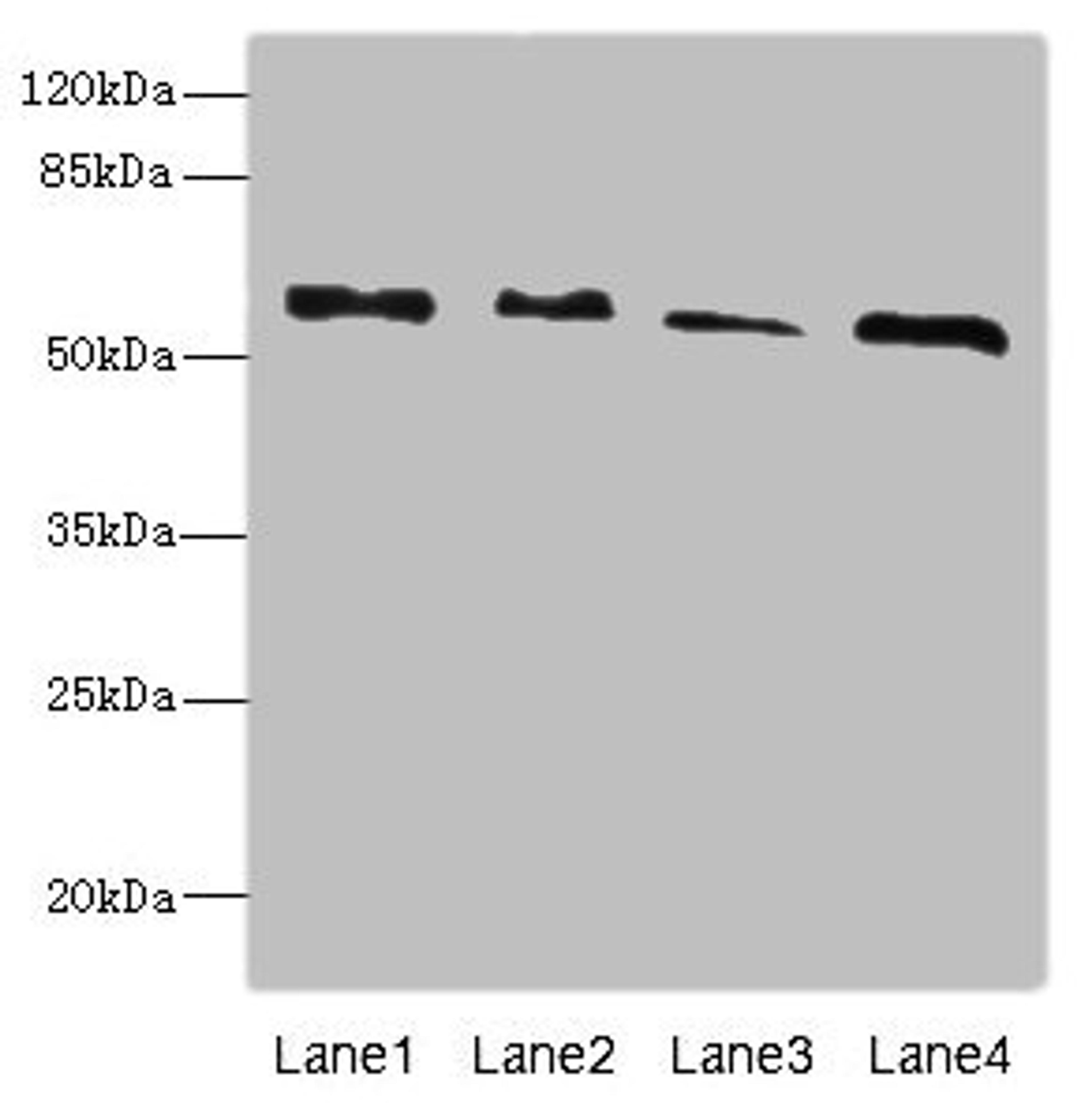 Western blot. All lanes: RTKN antibody at 4.66ug/ml. Lane 1: A431 whole cell lysate. Lane 2: HepG2 whole cell lysate. Lane 3: MCF-7 whole cell lysate. Lane 4: Mouse brain tissue. Secondary. Goat polyclonal to rabbit IgG at 1/10000 dilution. Predicted band size: 63, 62, 57 kDa. Observed band size: 63 kDa. 
