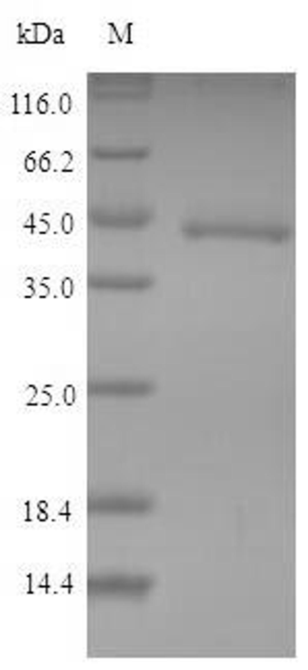 (Tris-Glycine gel) Discontinuous SDS-PAGE (reduced) with 5% enrichment gel and 15% separation gel.