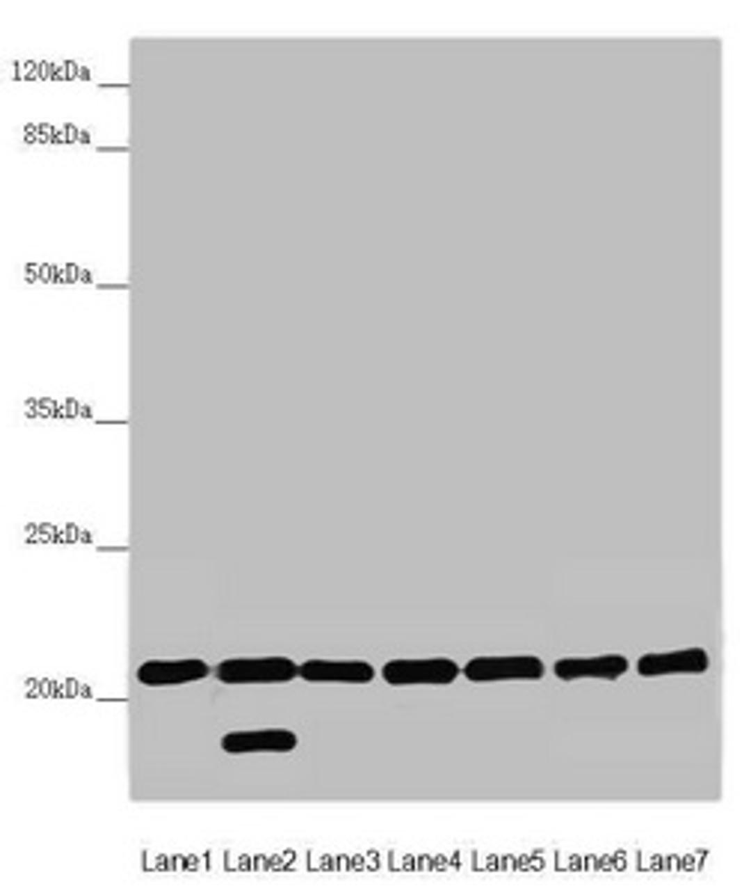 Western blot. All lanes: DCTN6 antibody at 3.03 ug/ml. Lane 1: Mouse lung tissue. Lane 2: Mouse gonadal tissue. Lane 3: A549 whole cell lysate. Lane 4: U251 whole cell lysate. Lane 5: Mouse thymus tissue. Lane 6: Rat brain tissue. Lane 7: Mouse stomach tissue. Secondary. Goat polyclonal to rabbit IgG at 1/10000 dilution. Predicted band size: 21 kDa. Observed band size: 21, 18 kDa.