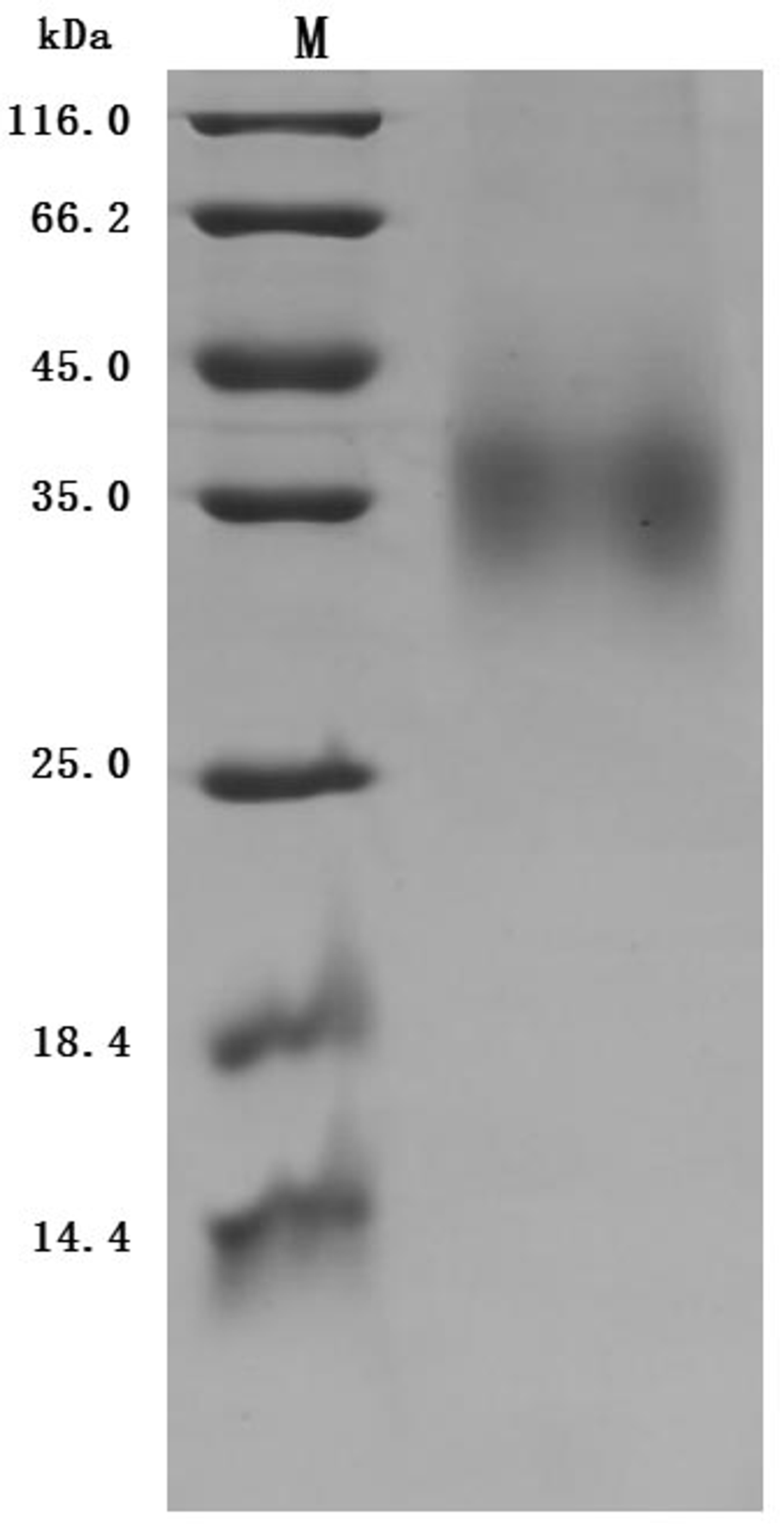 (Tris-Glycine gel) Discontinuous SDS-PAGE (reduced) with 5% enrichment gel and 15% separation gel.