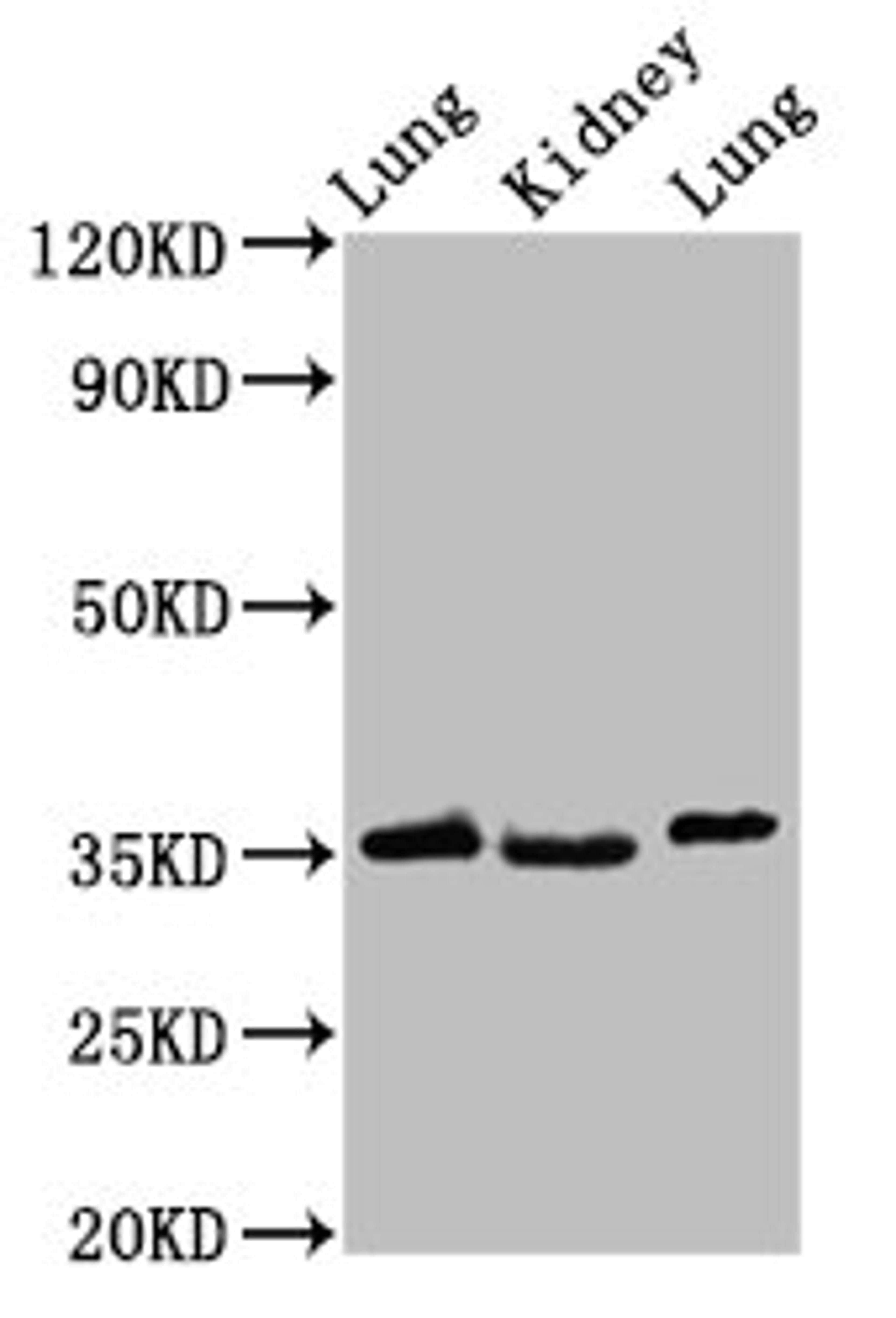 Western Blot. Positive WB detected in: Rat lung tissue, Rat kidney tissue, Mouse lung tissue. All lanes: HOXD1 antibody at 2.4ug/ml. Secondary. Goat polyclonal to rabbit IgG at 1/50000 dilution. Predicted band size: 35 kDa. Observed band size: 35 kDa. 