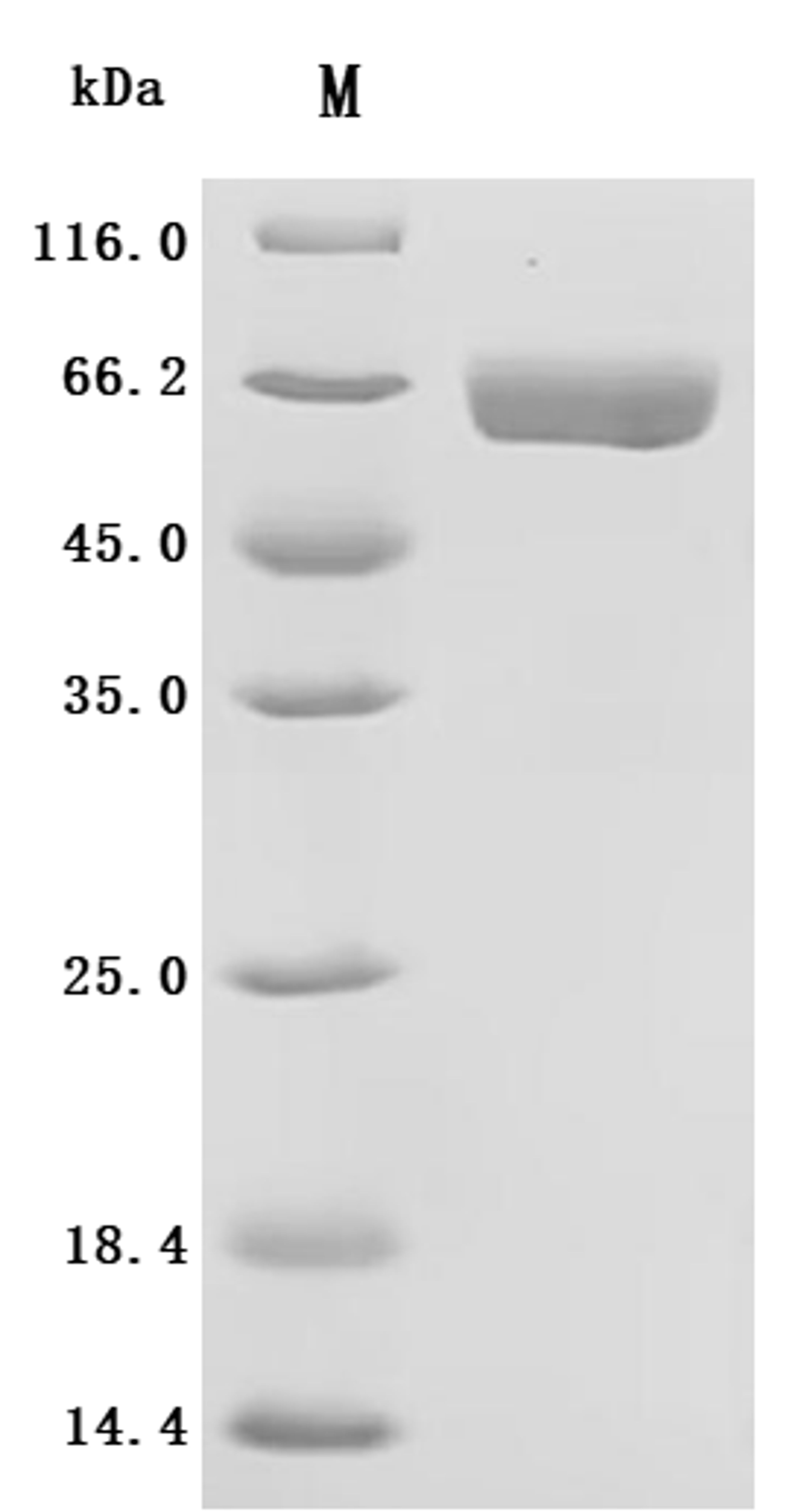 (Tris-Glycine gel) Discontinuous SDS-PAGE (reduced) with 5% enrichment gel and 15% separation gel.