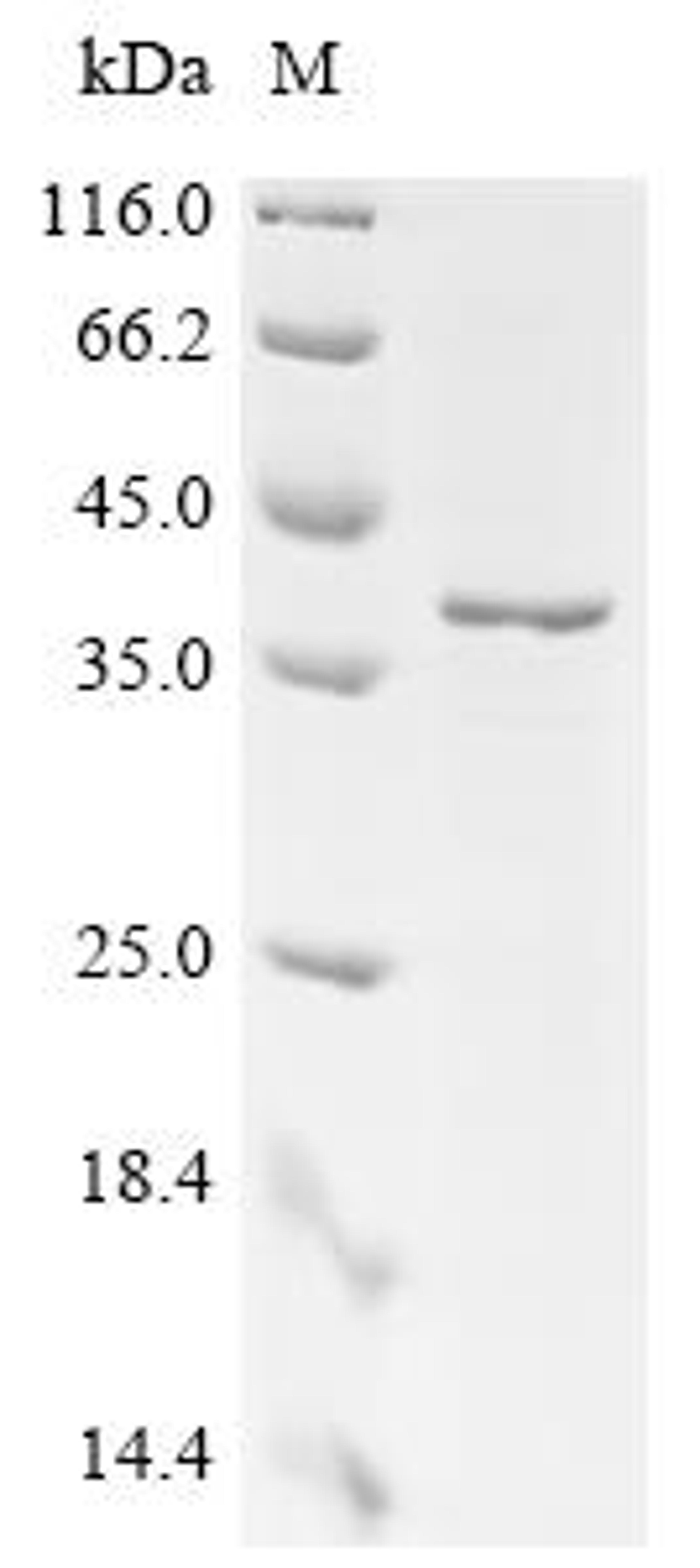 (Tris-Glycine gel) Discontinuous SDS-PAGE (reduced) with 5% enrichment gel and 15% separation gel.