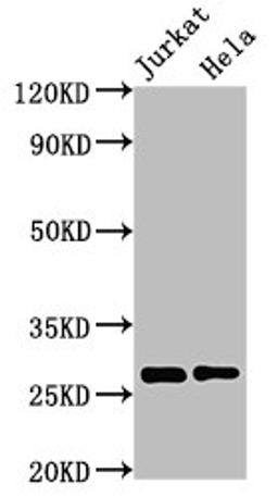 Western Blot. Positive WB detected in: Jurkat whole cell lysate, Hela whole cell lysate. All lanes: HSD17B10 antibody at 3µg/ml. Secondary. Goat polyclonal to rabbit IgG at 1/50000 dilution. Predicted band size: 27, 26 kDa. Observed band size: 27 kDa