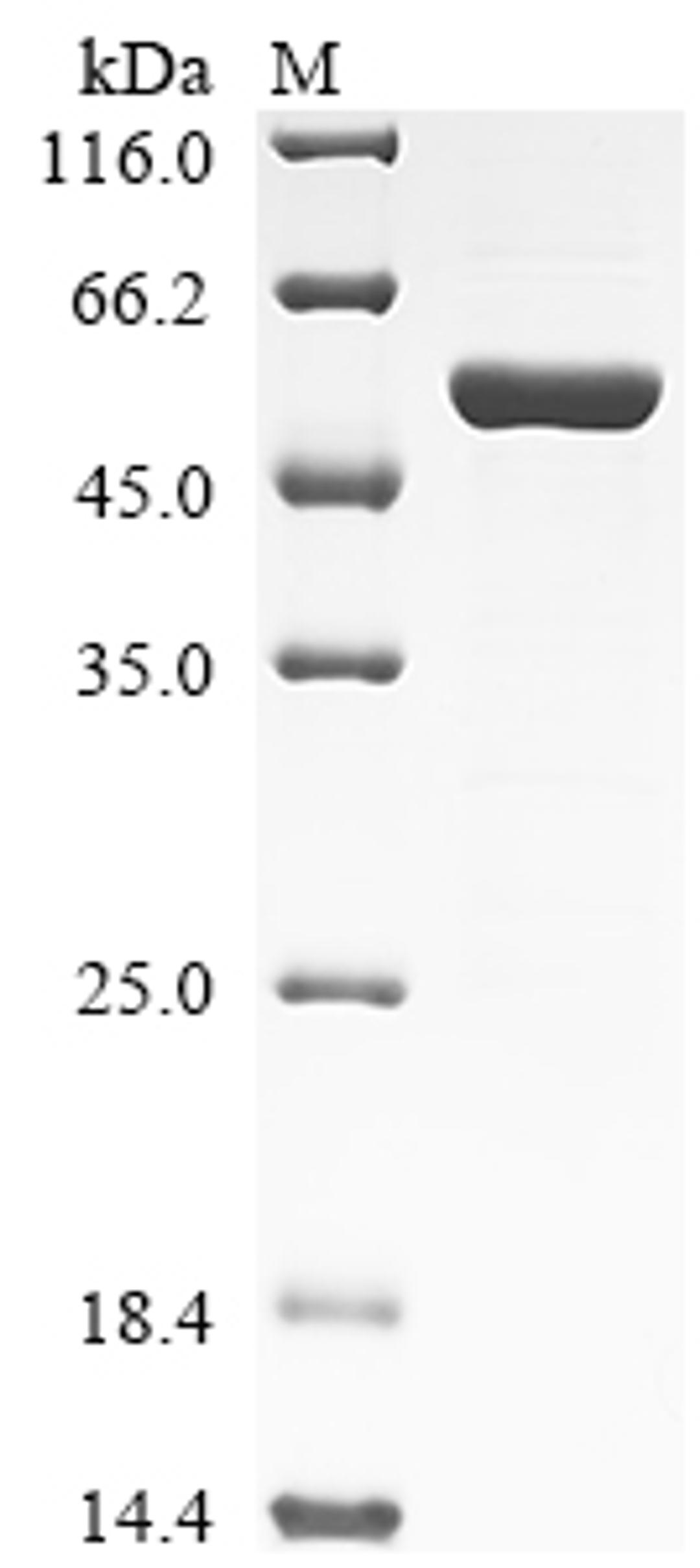 (Tris-Glycine gel) Discontinuous SDS-PAGE (reduced) with 5% enrichment gel and 15% separation gel.