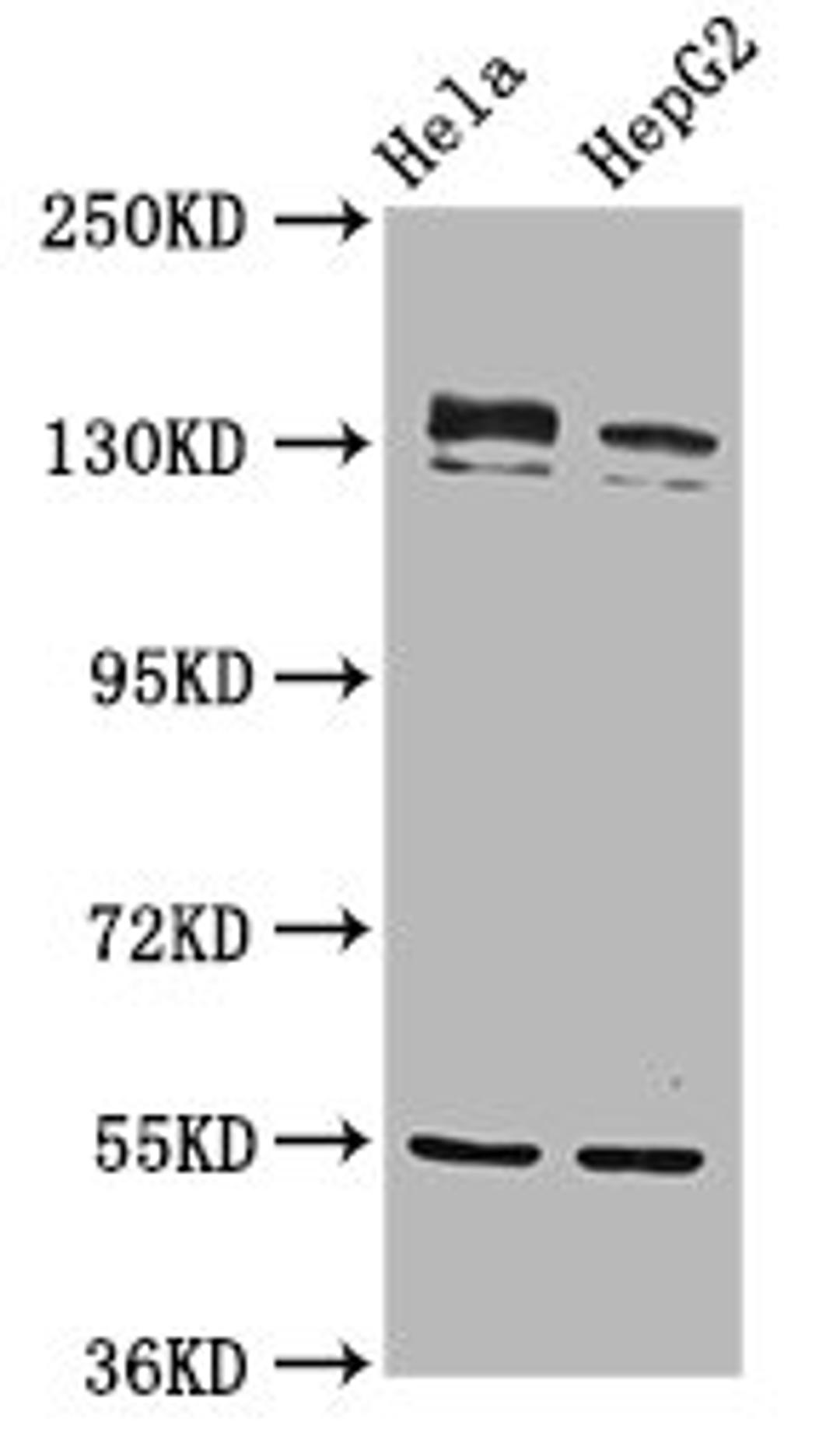 Western Blot. Positive WB detected in: Hela whole cell lysate, HepG2 whole cell lysate. All lanes: RECQL4 antibody at 4.8µg/ml. Secondary. Goat polyclonal to rabbit IgG at 1/50000 dilution. Predicted band size: 134 kDa. Observed band size: 134 kDa
