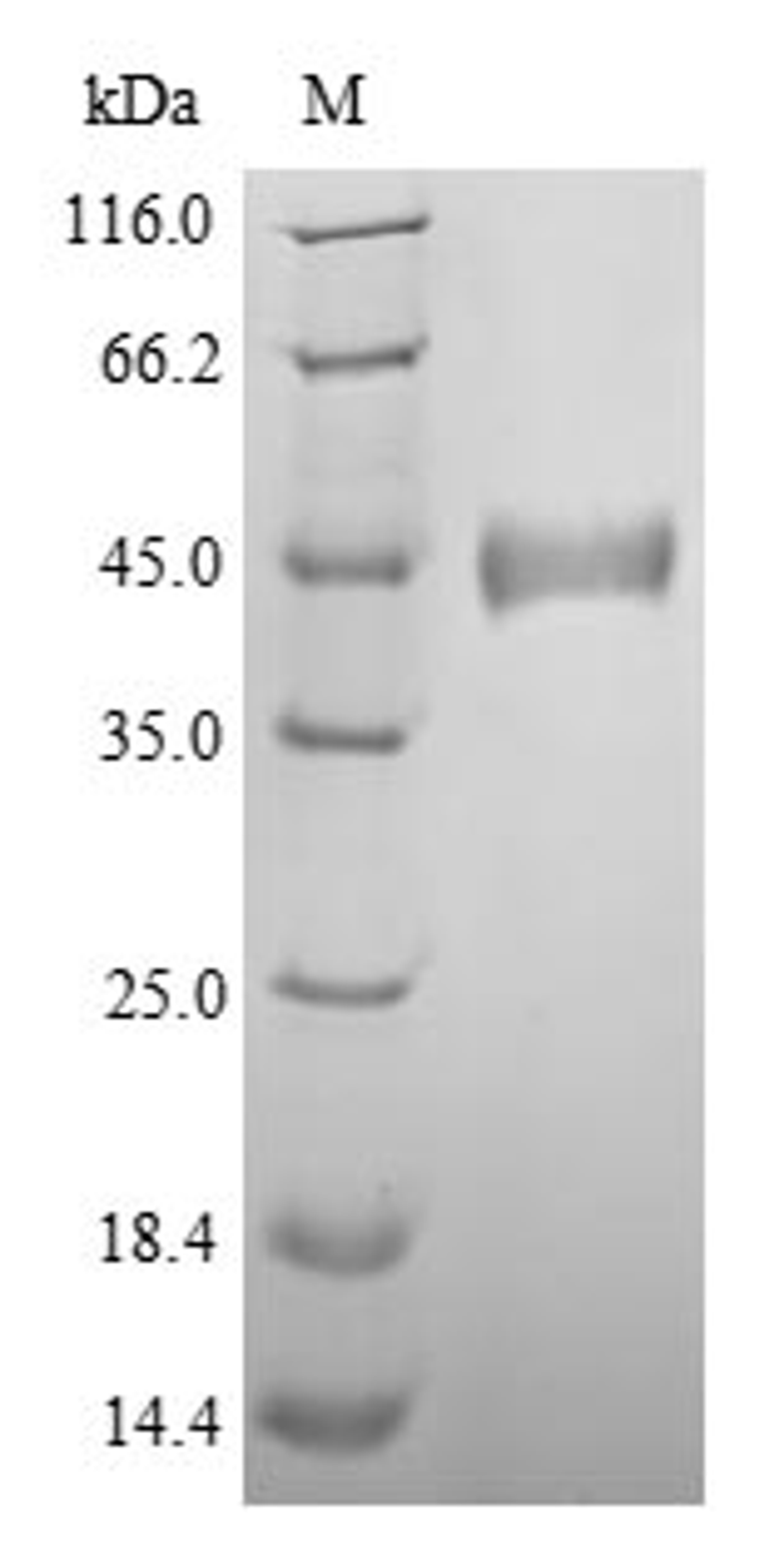 (Tris-Glycine gel) Discontinuous SDS-PAGE (reduced) with 5% enrichment gel and 15% separation gel.