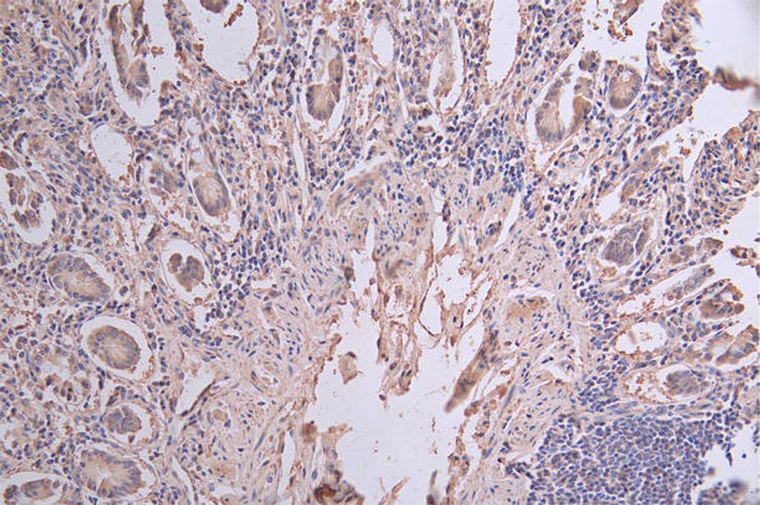 IHC image of CSB-RA176322A0HU diluted at 1:50 and staining in paraffin-embedded human small intestine tissue performed on a Leica BondTM system. After dewaxing and hydration, antigen retrieval was mediated by high pressure in a citrate buffer (pH 6.0). Section was blocked with 10% normal goat serum 30min at RT. Then primary antibody (1% BSA) was incubated at 4°C overnight. The primary is detected by a Goat anti-rabbit polymer IgG labeled by HRP and visualized using 0.61% DAB.