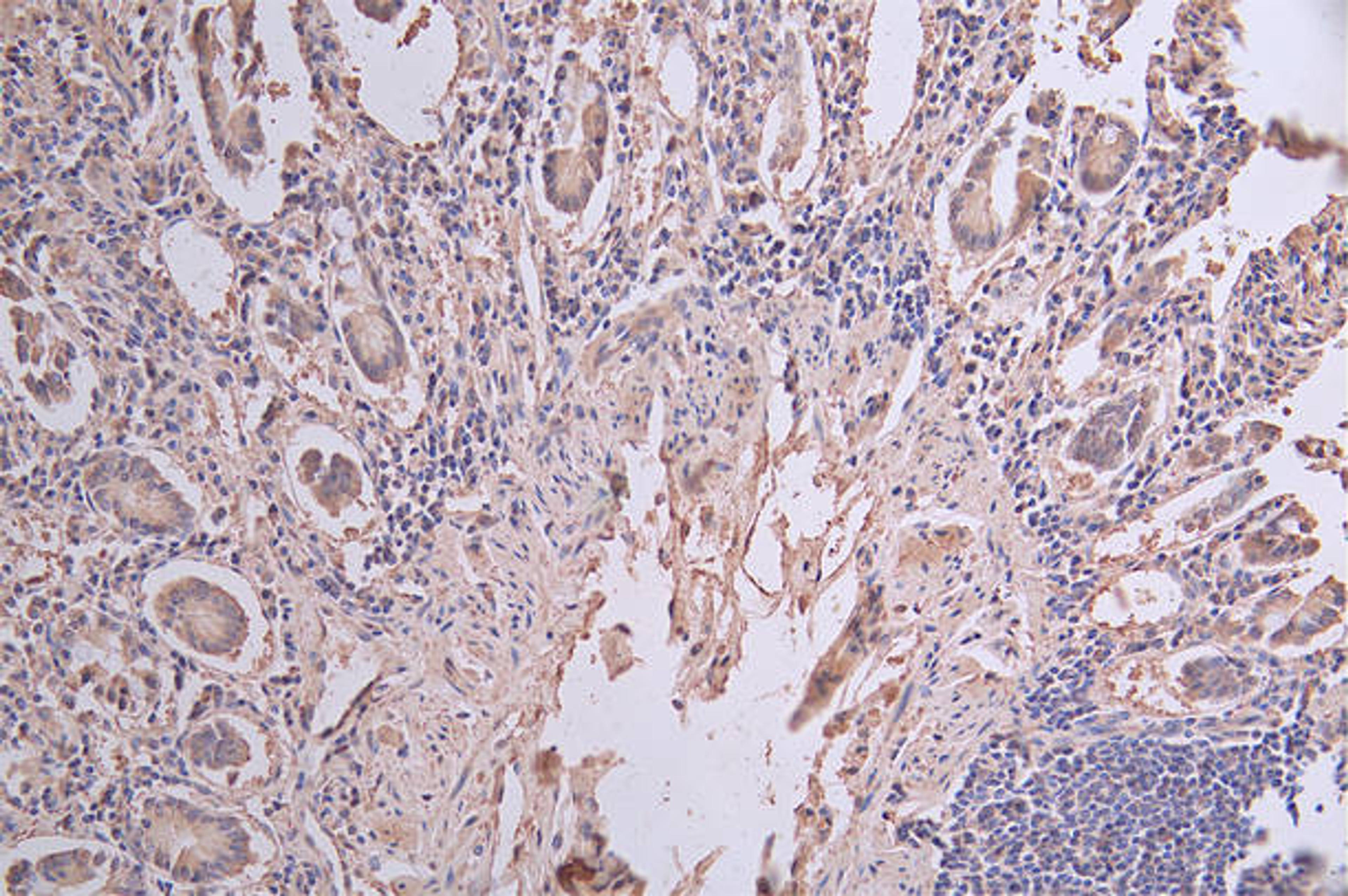 IHC image of CSB-RA176322A0HU diluted at 1:50 and staining in paraffin-embedded human small intestine tissue performed on a Leica BondTM system. After dewaxing and hydration, antigen retrieval was mediated by high pressure in a citrate buffer (pH 6.0). Section was blocked with 10% normal goat serum 30min at RT. Then primary antibody (1% BSA) was incubated at 4°C overnight. The primary is detected by a Goat anti-rabbit polymer IgG labeled by HRP and visualized using 0.61% DAB.