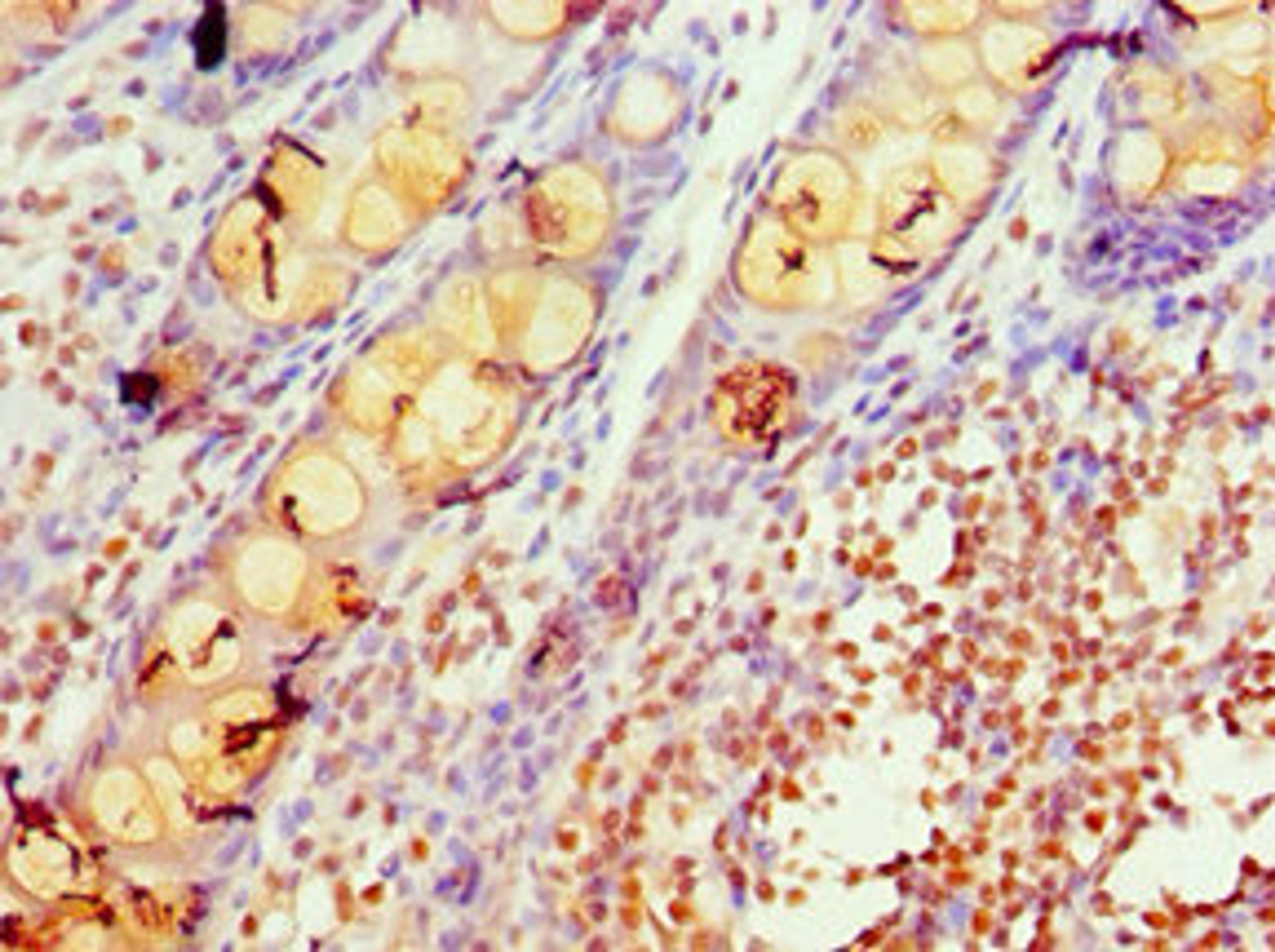 Immunohistochemistry of paraffin-embedded human colon tissue using CSB-PA012086ESR1HU at dilution of 1:100
