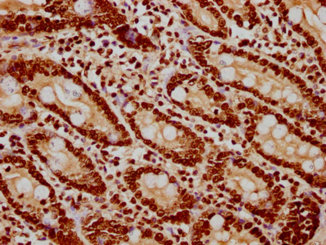 IHC image of CSB-PA010418PA122nsucHU diluted at 1:20 and staining in paraffin-embedded human small intestine tissue performed on a Leica BondTM system. After dewaxing and hydration, antigen retrieval was mediated by high pressure in a citrate buffer (pH 6.0). Section was blocked with 10% normal goat serum 30min at RT. Then primary antibody (1% BSA) was incubated at 4°C overnight. The primary is detected by a biotinylated secondary antibody and visualized using an HRP conjugated SP system.