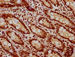 IHC image of CSB-PA010418PA122nsucHU diluted at 1:20 and staining in paraffin-embedded human small intestine tissue performed on a Leica BondTM system. After dewaxing and hydration, antigen retrieval was mediated by high pressure in a citrate buffer (pH 6.0). Section was blocked with 10% normal goat serum 30min at RT. Then primary antibody (1% BSA) was incubated at 4°C overnight. The primary is detected by a biotinylated secondary antibody and visualized using an HRP conjugated SP system.