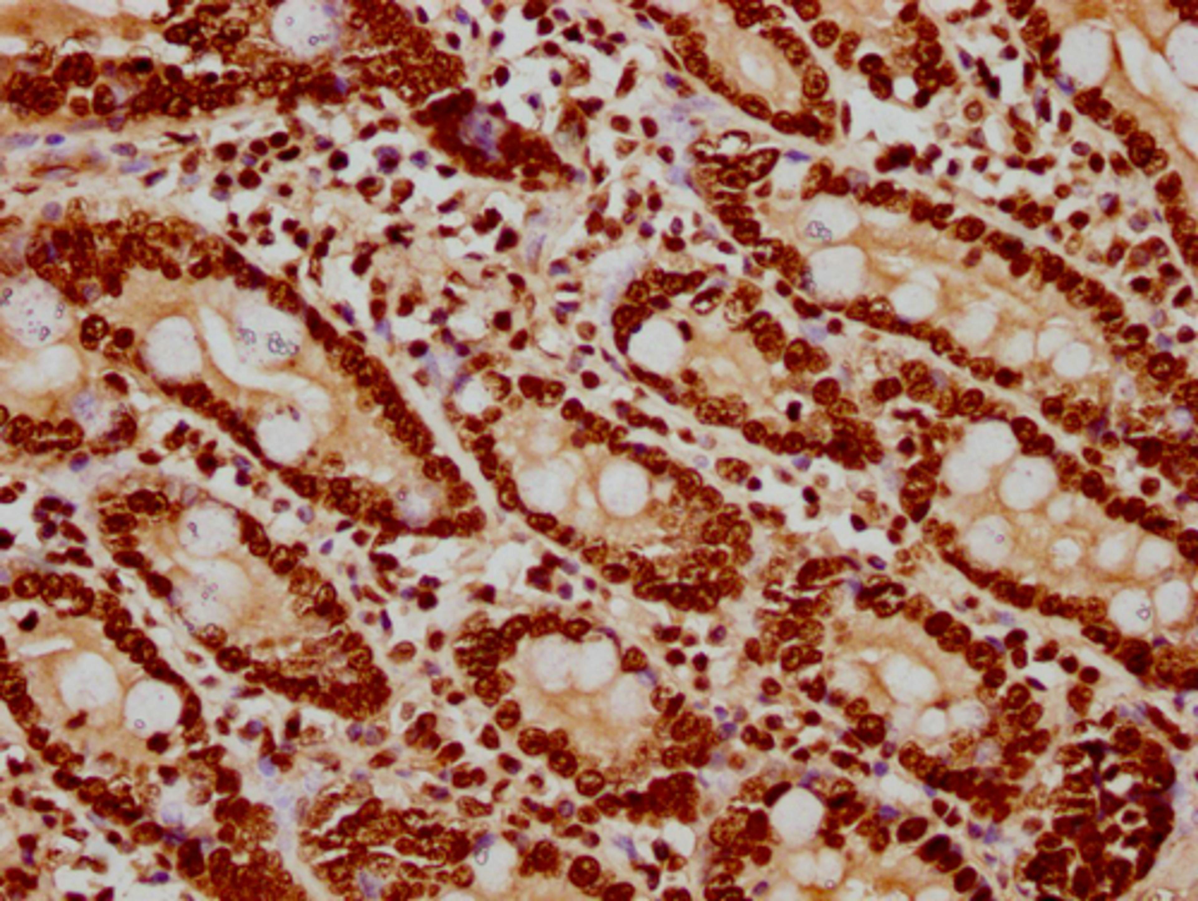 IHC image of CSB-PA010418PA122nsucHU diluted at 1:20 and staining in paraffin-embedded human small intestine tissue performed on a Leica BondTM system. After dewaxing and hydration, antigen retrieval was mediated by high pressure in a citrate buffer (pH 6.0). Section was blocked with 10% normal goat serum 30min at RT. Then primary antibody (1% BSA) was incubated at 4°C overnight. The primary is detected by a biotinylated secondary antibody and visualized using an HRP conjugated SP system.