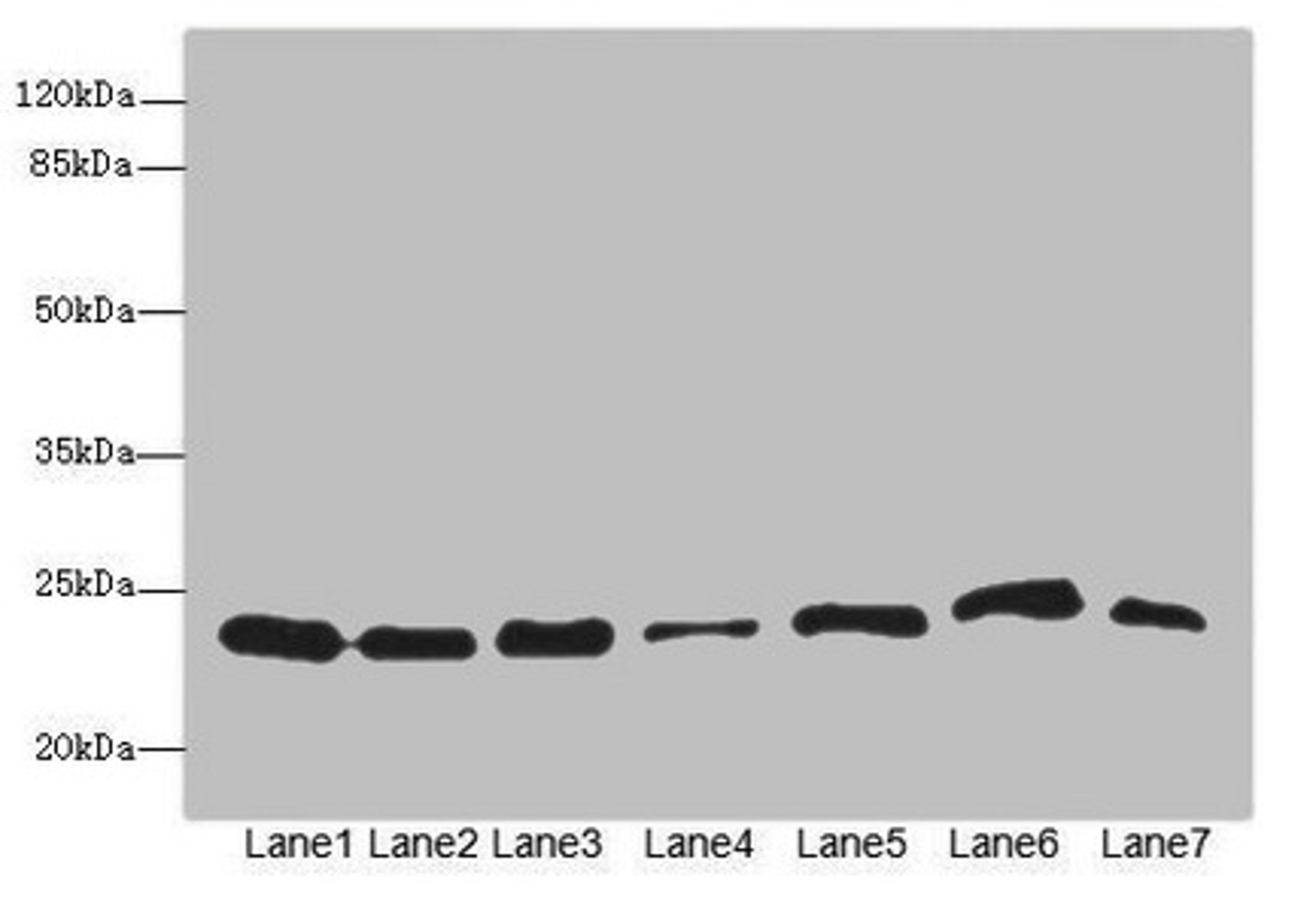 Western blot. All lanes: PSMB3 antibody at 3.73µg/ml. Lane 1: Hela whole cell lysate. Lane 2: MCF-7 whole cell lysate. Lane 3: HepG2 whole cell lysate. Lane 4: K562 whole cell lysate. Lane 5: Jurkat whole cell lysate. Lane 6: NIH/3T3 whole cell lysate. Lane 7: 293T whole cell lysate. Secondary. Goat polyclonal to rabbit IgG at 1/10000 dilution. Predicted band size: 23 kDa. Observed band size: 23 kDa