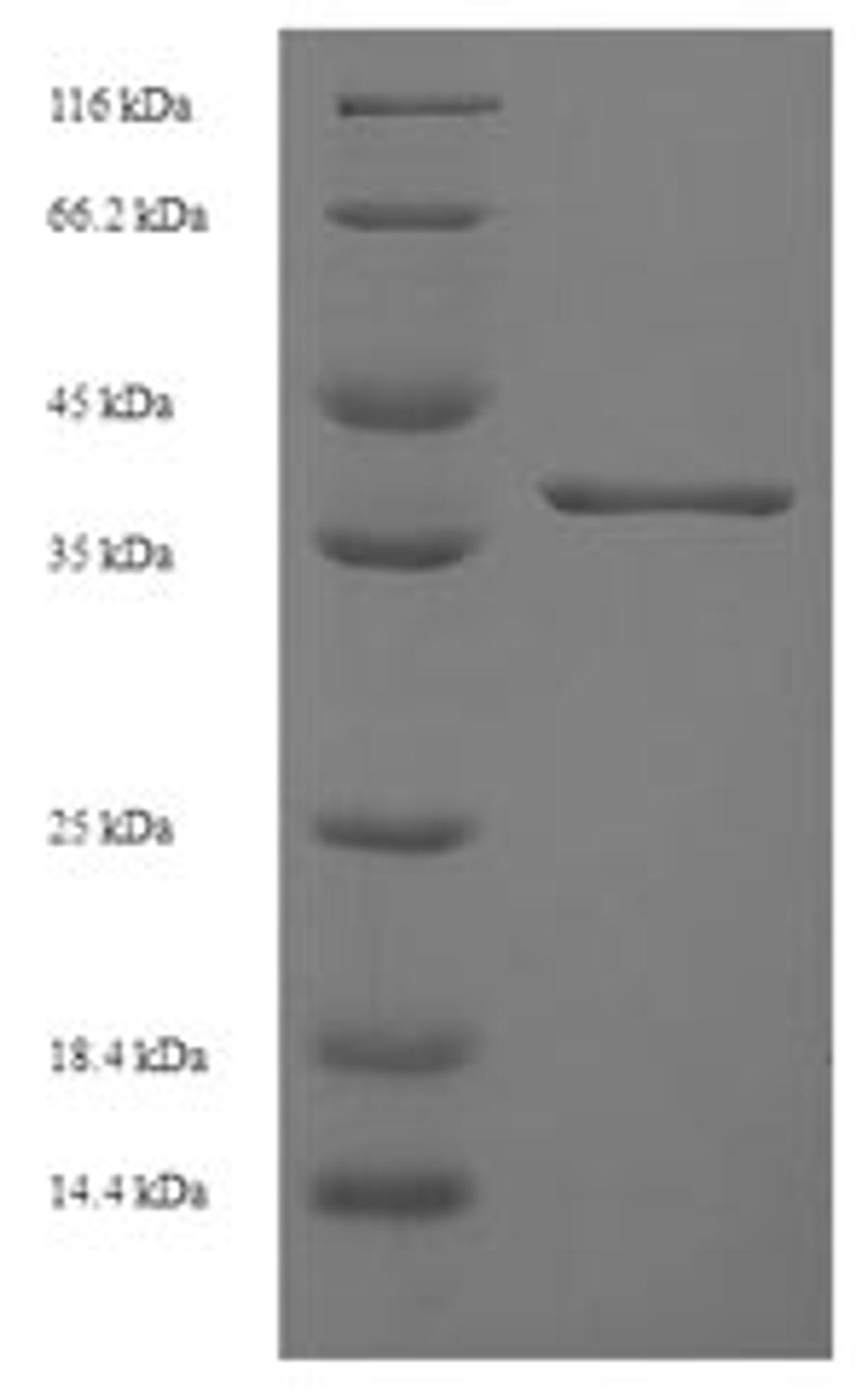 (Tris-Glycine gel) Discontinuous SDS-PAGE (reduced) with 5% enrichment gel and 15% separation gel.
