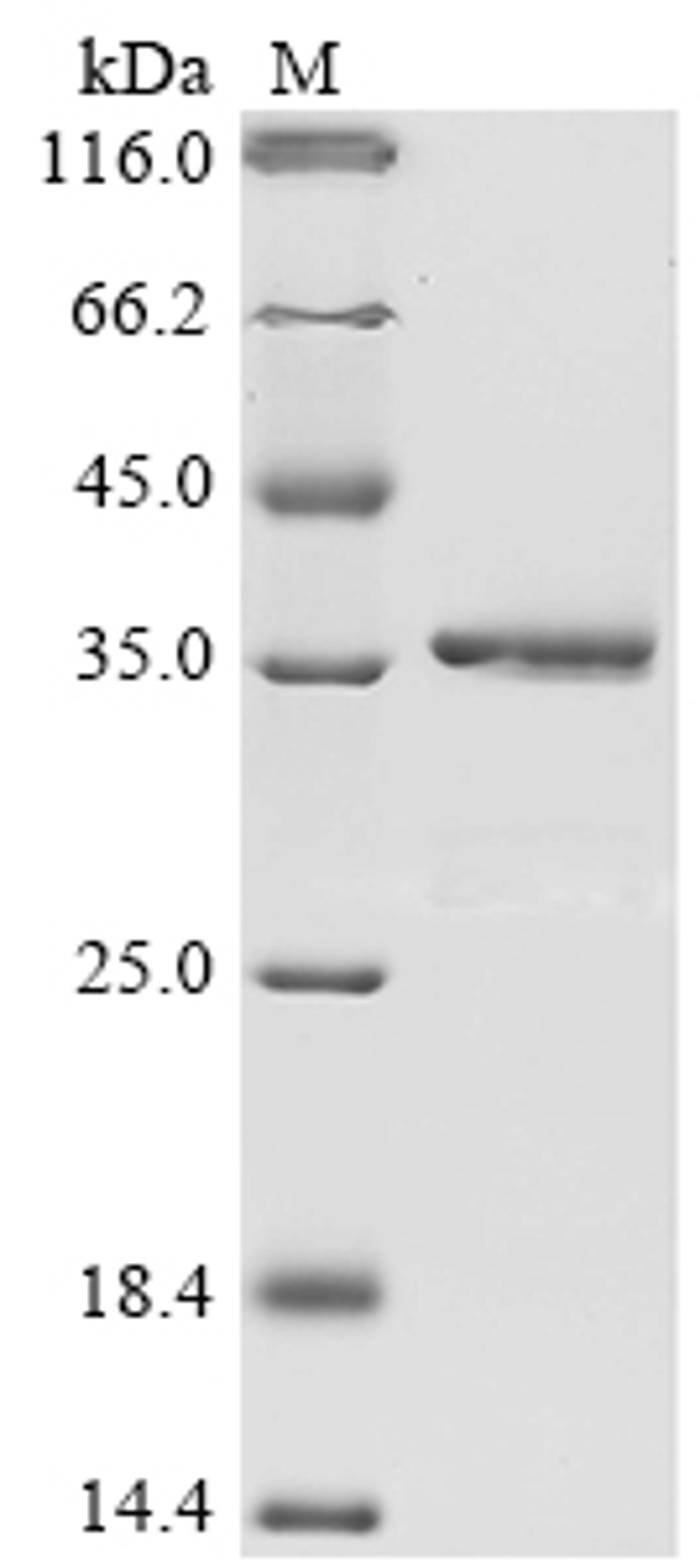 (Tris-Glycine gel) Discontinuous SDS-PAGE (reduced) with 5% enrichment gel and 15% separation gel.