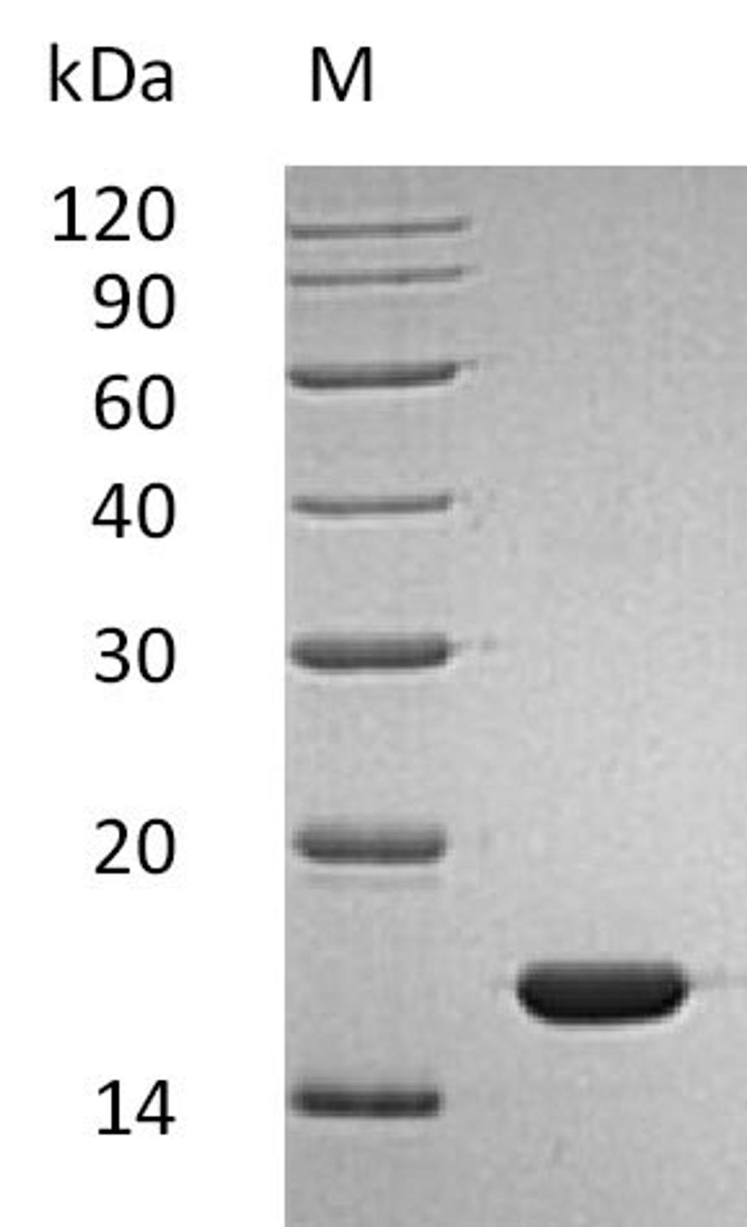 (Tris-Glycine gel) Discontinuous SDS-PAGE (reduced) with 5% enrichment gel and 15% separation gel.